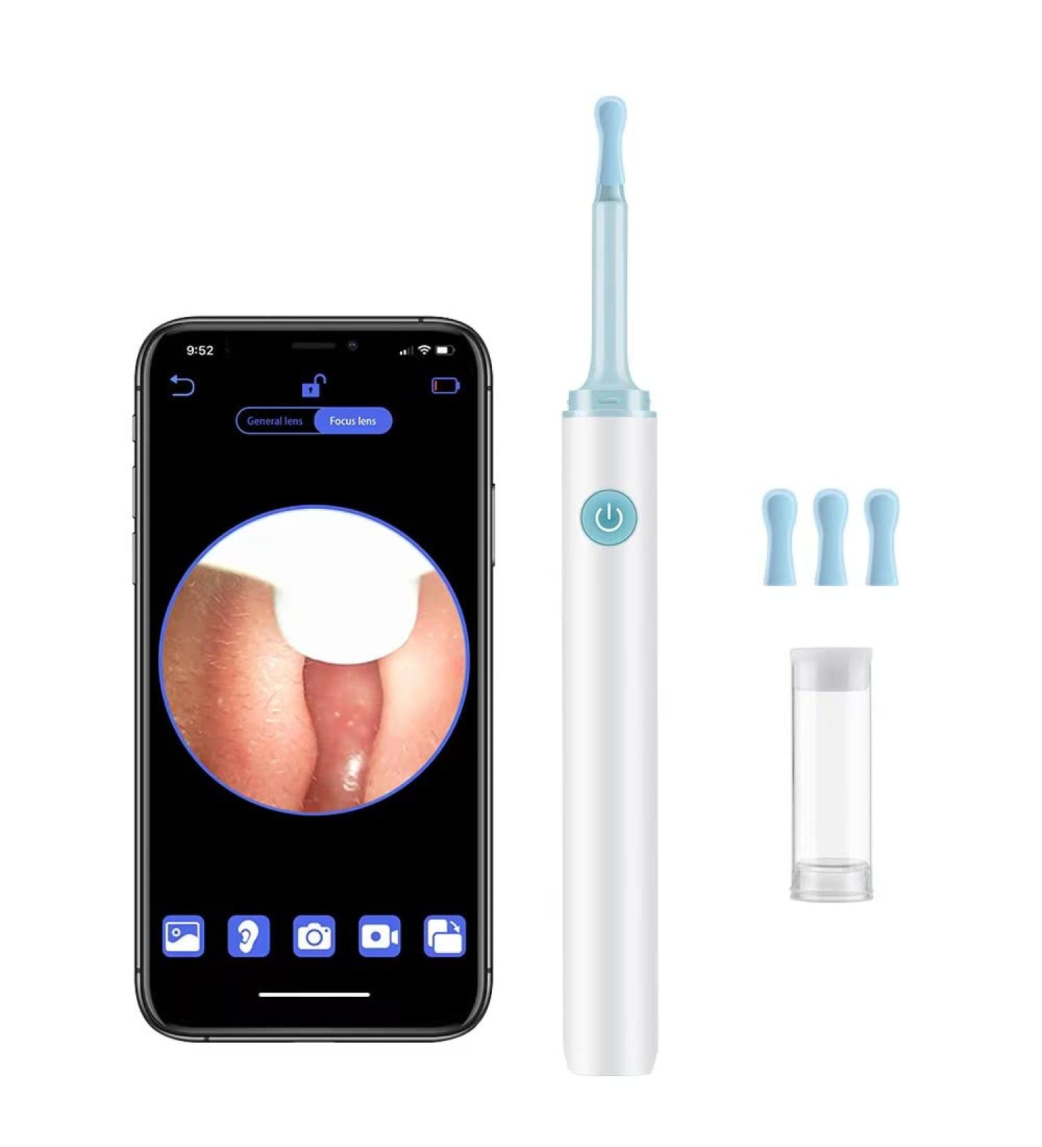 ONIYEA 3.9mm Ultra Thin Ear Wax Remover Tool Camera - Smart Visual Ear Cleaner, Wireless Otoscope for Android and iOS - Buy Online on GoSupps.com