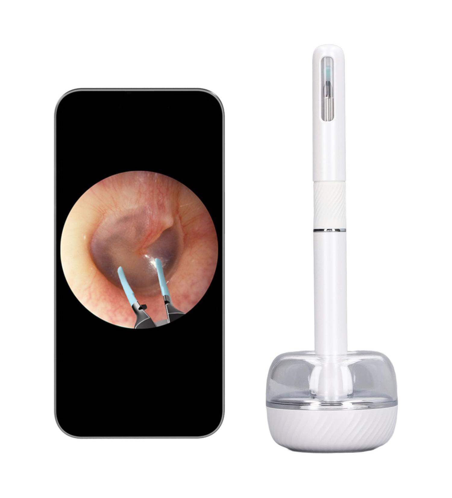 Ear Wax Removal Tool with Camera & LED Light | 10MP Otoscope for Adults & Kids (White) - Buy Online on GoSupps.com