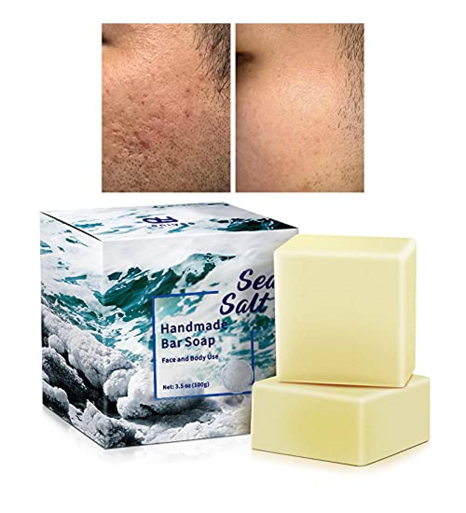 Oniyea Sea Salt Soap 3.5 oz - Exfoliating Acne Treatment with Goat's Milk for All Skin Types - 2 Pack for Face & Body - Perfect Skincare Gift for Women & Men - Buy Online on GoSupps.com