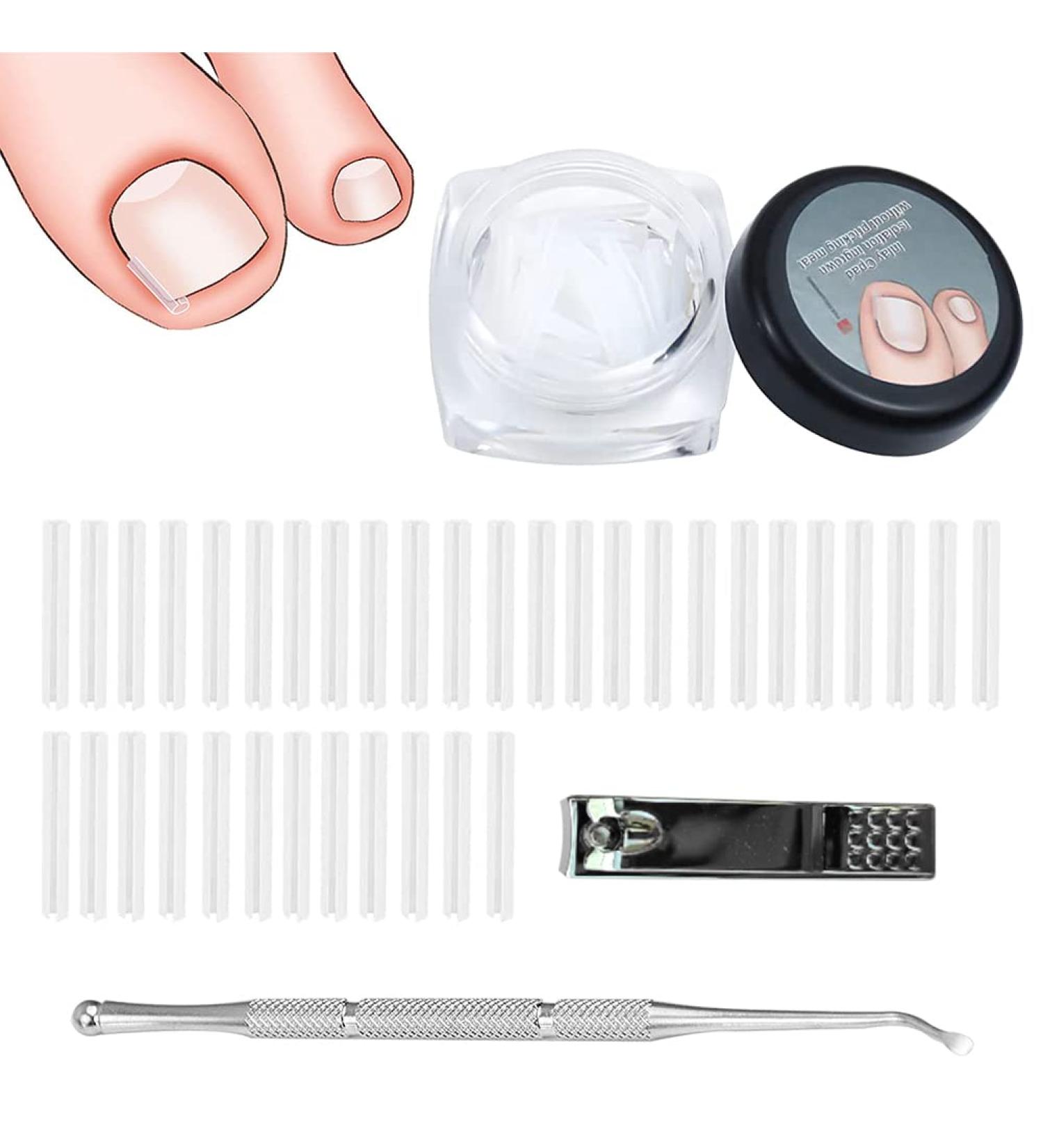 Toenail Corrector Patch Ingrown Nail Corrector Ingrown Nail Treatment Ingrown Nail Corrector Stickers Toenail Correction Toenail Patch - Buy Online on GoSupps.com