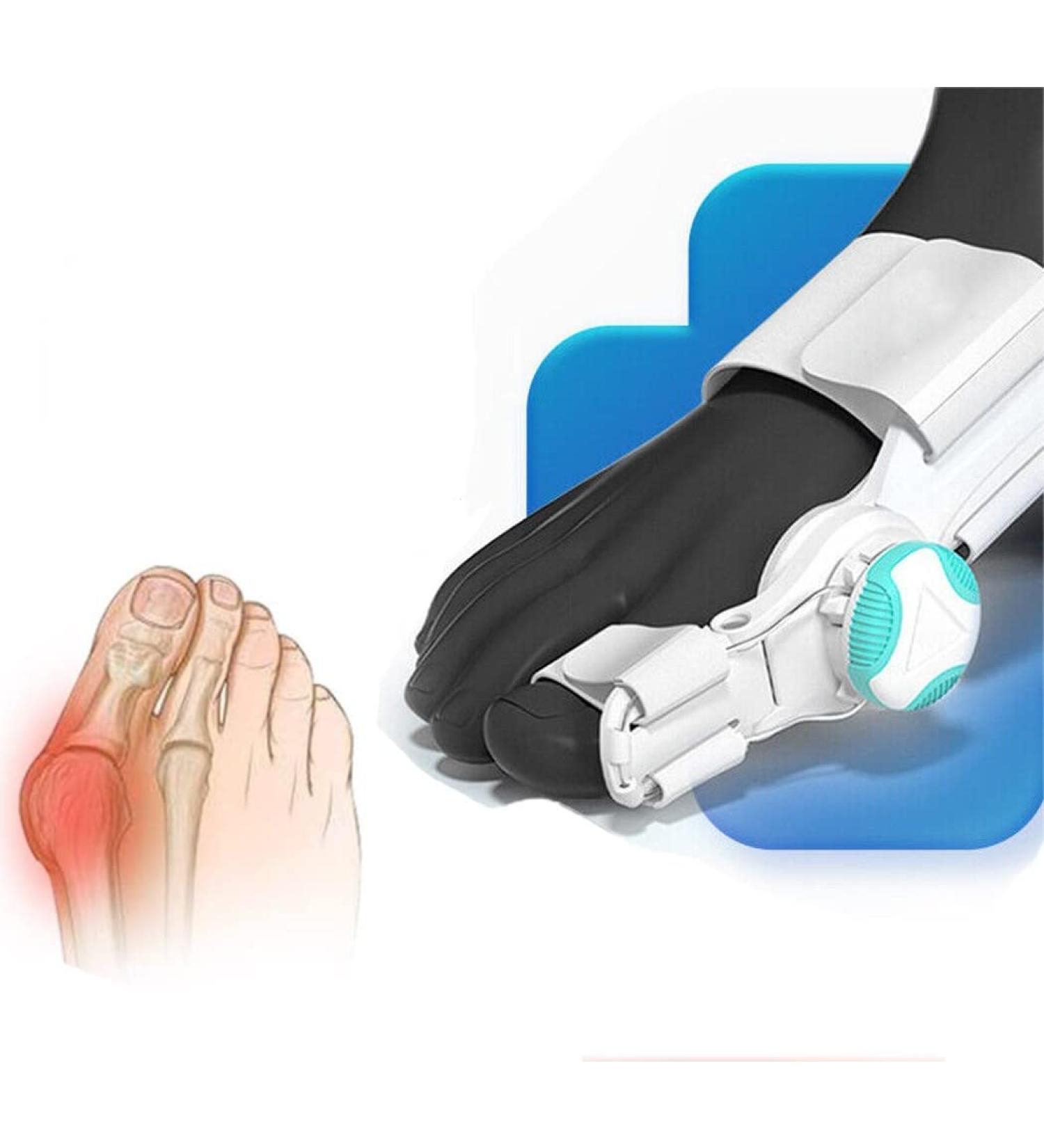 Vduck Bunion Corrector - Adjustable Big Toe Straightener with Silicone Pad | International Shipping - Buy Online on GoSupps.com