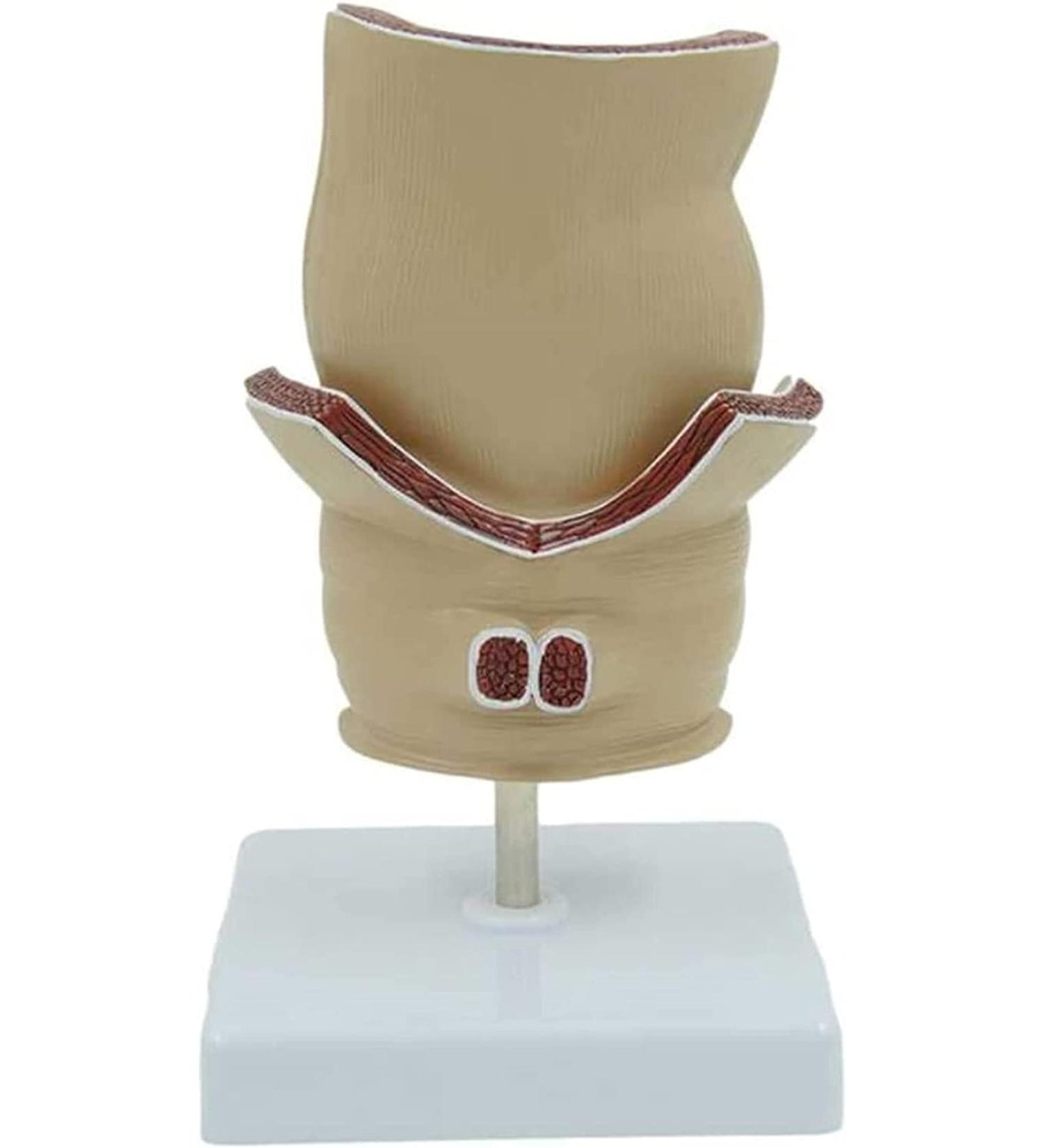 Human Rectal Hemorrhoid Lesions ical Model Colon Anal Sphincter Anorectal Teaching Specimen - Buy Online on GoSupps.com