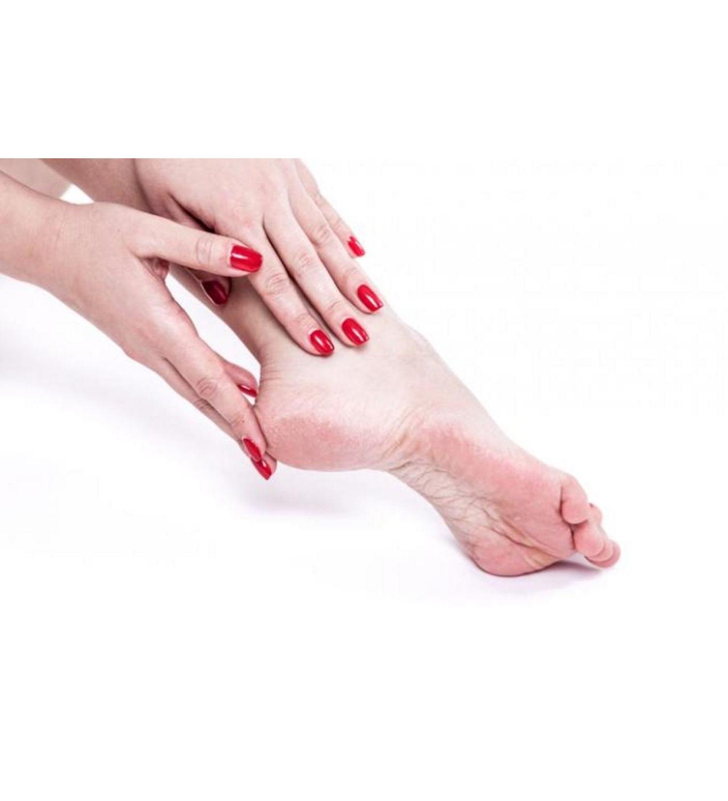 Dry Foot Heel Balm Moisturising Cracked Skin - Buy Online on GoSupps.com