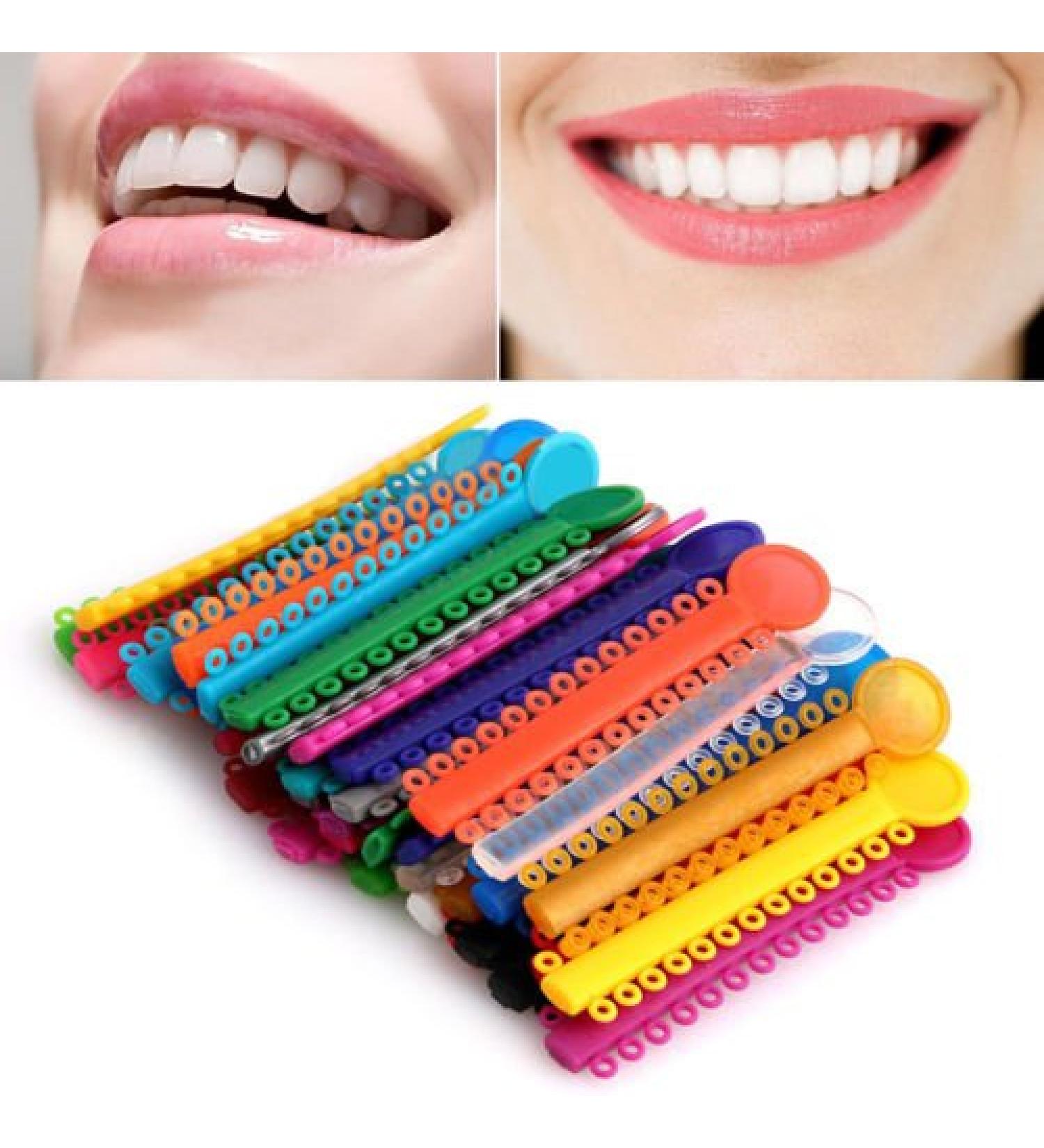 Ocean Aquarius Dental Orthodontic Elastic Ligature Ties 1040Pcs - Multi-Color Rubber Bands - Buy Online on GoSupps.com