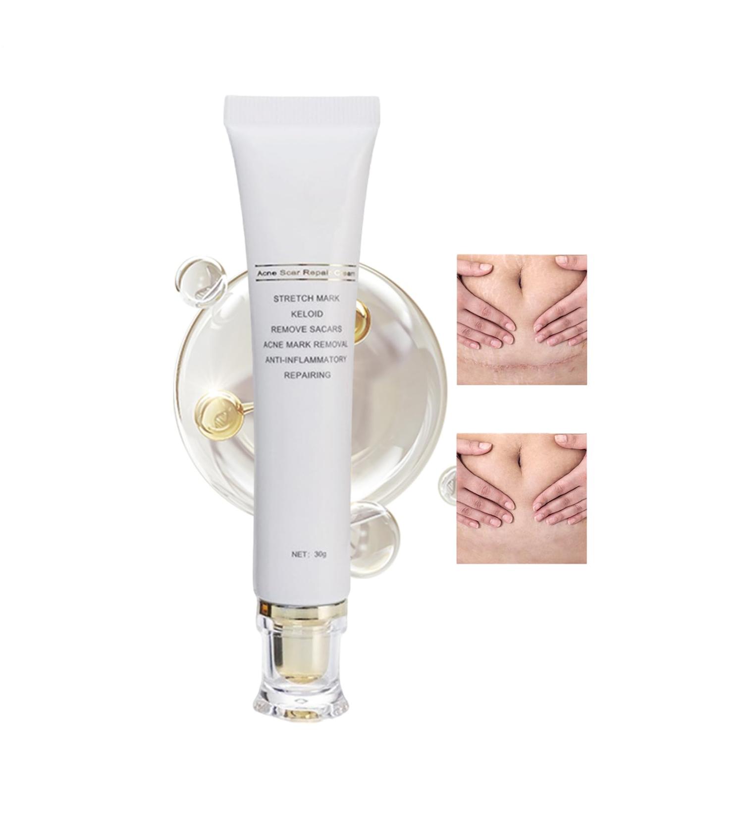 Scars Removal Cream Natural Moisturizing Skin Care Products 30g - Body & Skin Cream | For Morning Day Night Face Body Travel Home Piercing Cicatri Brands - Buy Online on GoSupps.com