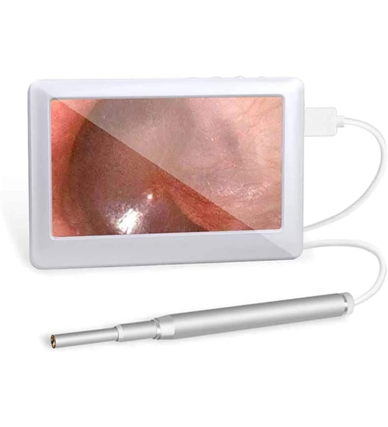 SMSOM Ear Wax Removal Tool HD Ear Wax Remover Otoscope with 6 LED Lights Endoscope Ear Pick 4.3 Inches Screen Earwax Removal Tools for Kids Adults White - Buy Online on GoSupps.com