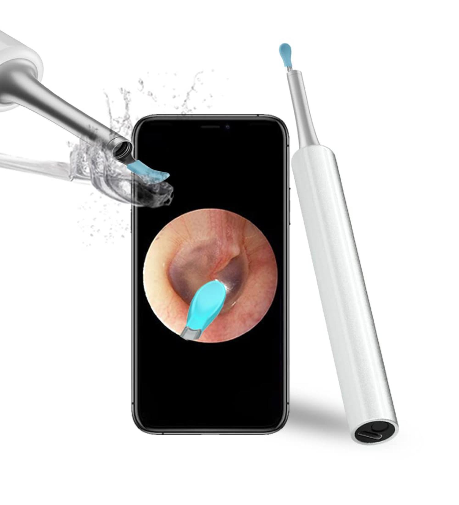 Ear Wax Removal Endoscope Otoscope Earwax Remover Tools Scope with 1080P FHD Camera 6 Led Lights Wireless Connected Compatible with iPhone iPad Android Smart Phones & Tablets (White)