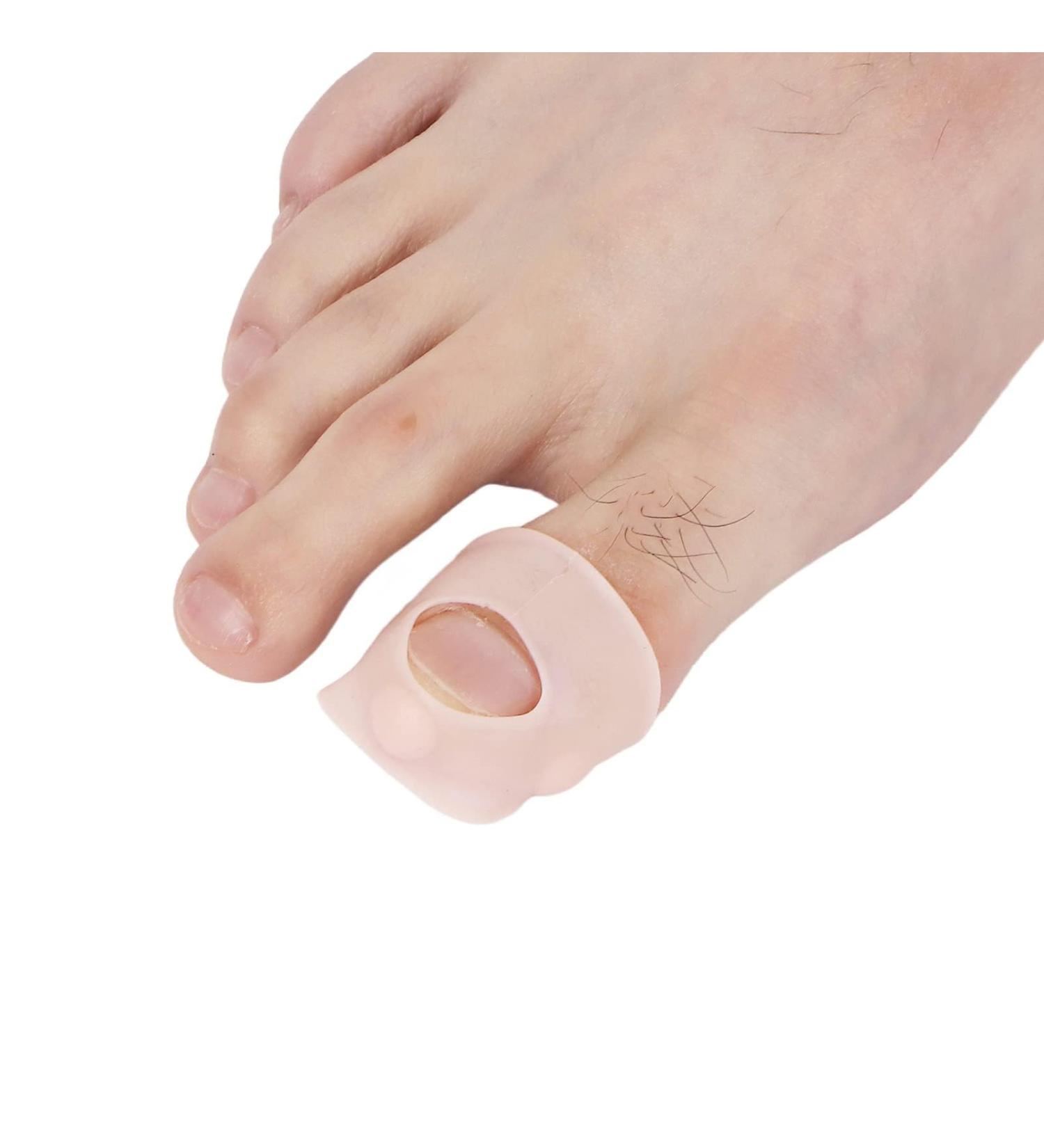 Ingrown Toenail Corrector - Elastic Silicone Clip & Pain Relief Tool for Healthy Nails | Unisex Solution - Buy Online on GoSupps.com