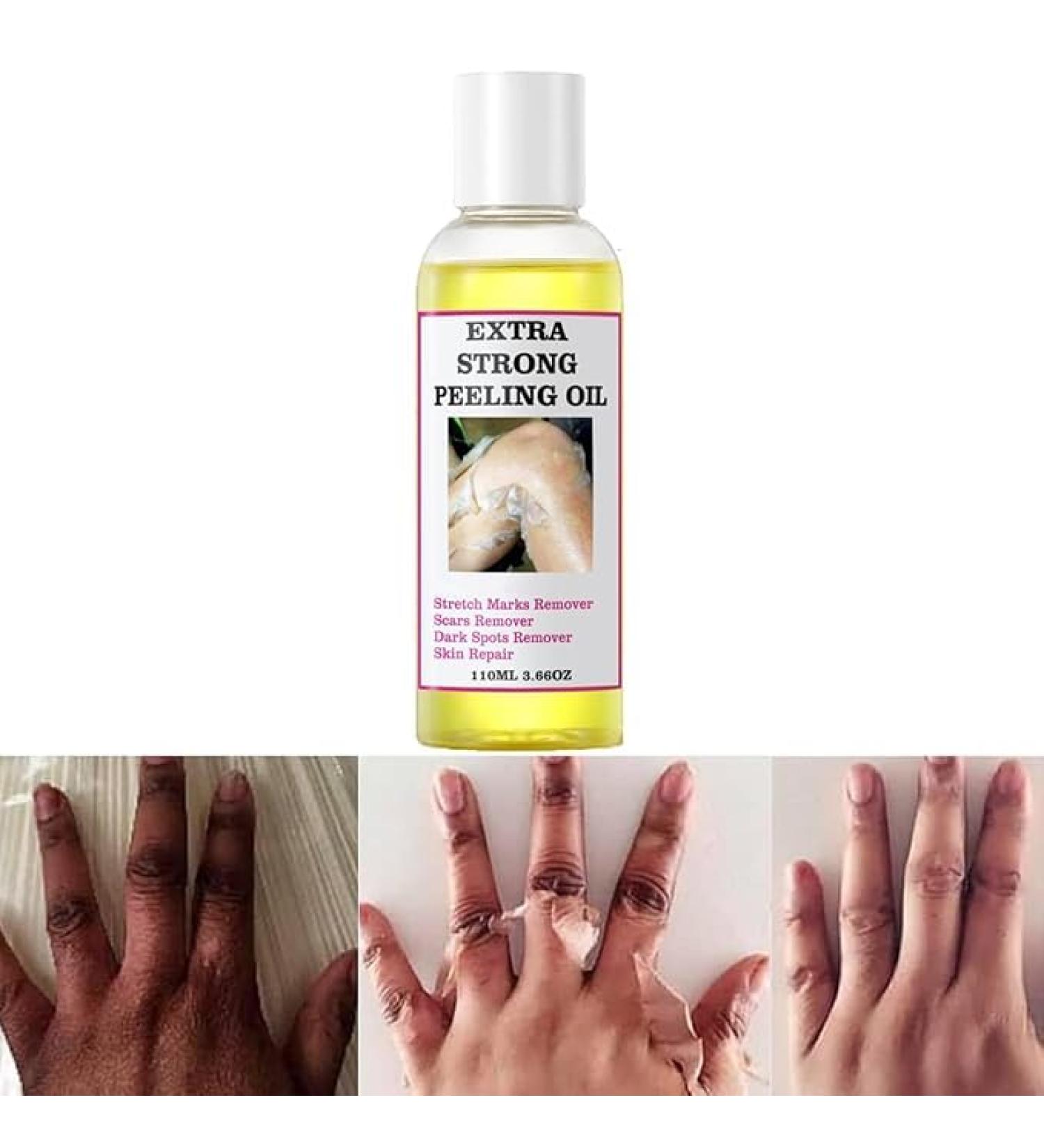 Generic Extra Strong Yellow Peeling Oil Exfoliating Solution for Body and Face 3.88 Fl Oz