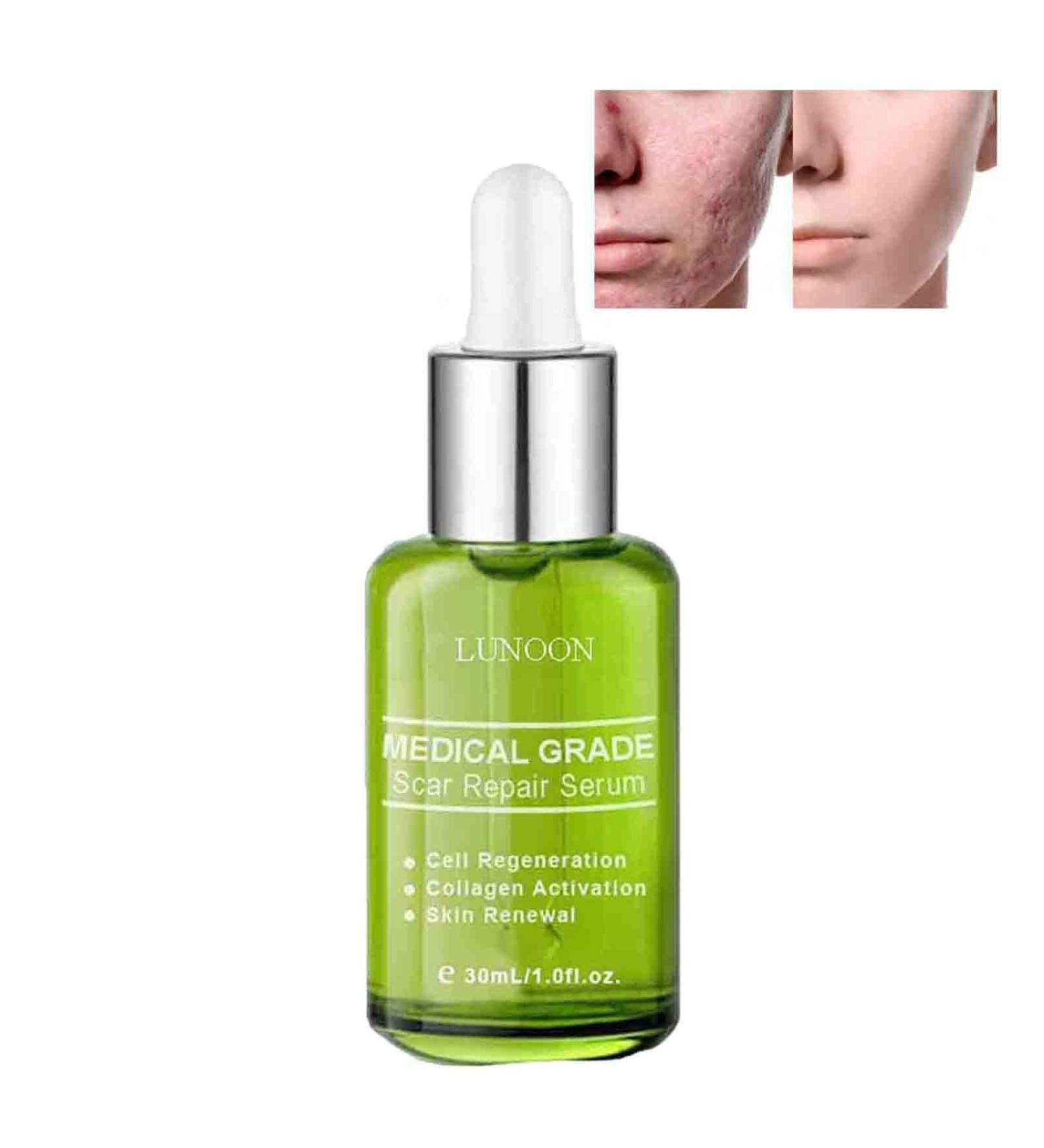 Goopgen Advanced Scar Repair Serum - Medical Grade Nature Treatment for All Types of Scars (1PC) - Buy Online on GoSupps.com