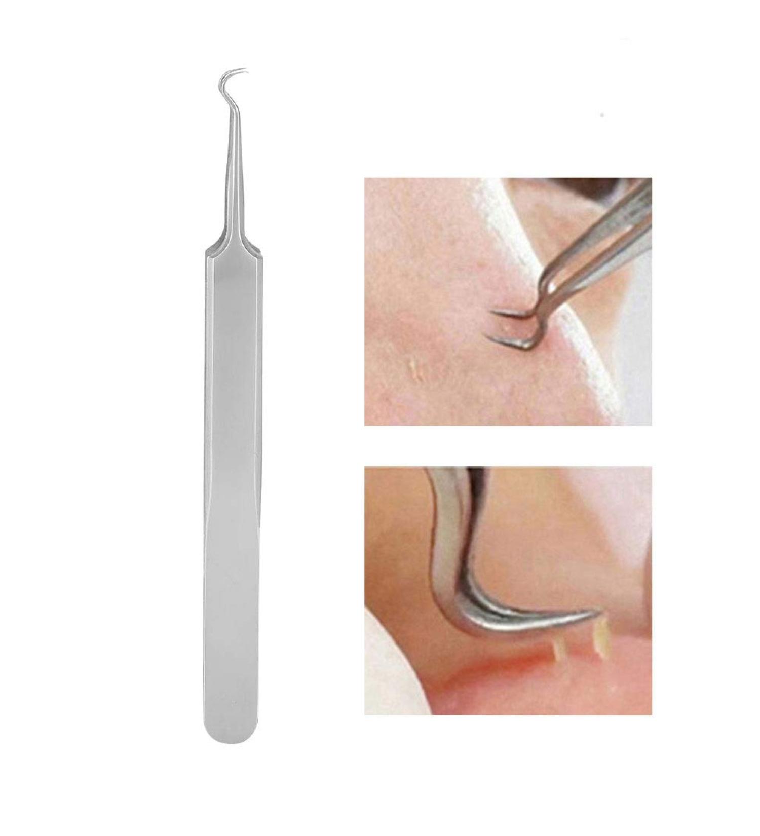 Stain Removal Tweezers & Blackhead Remover Tool | Stainless Steel Pore Cleaner for Perfect Skin - Buy Online on GoSupps.com