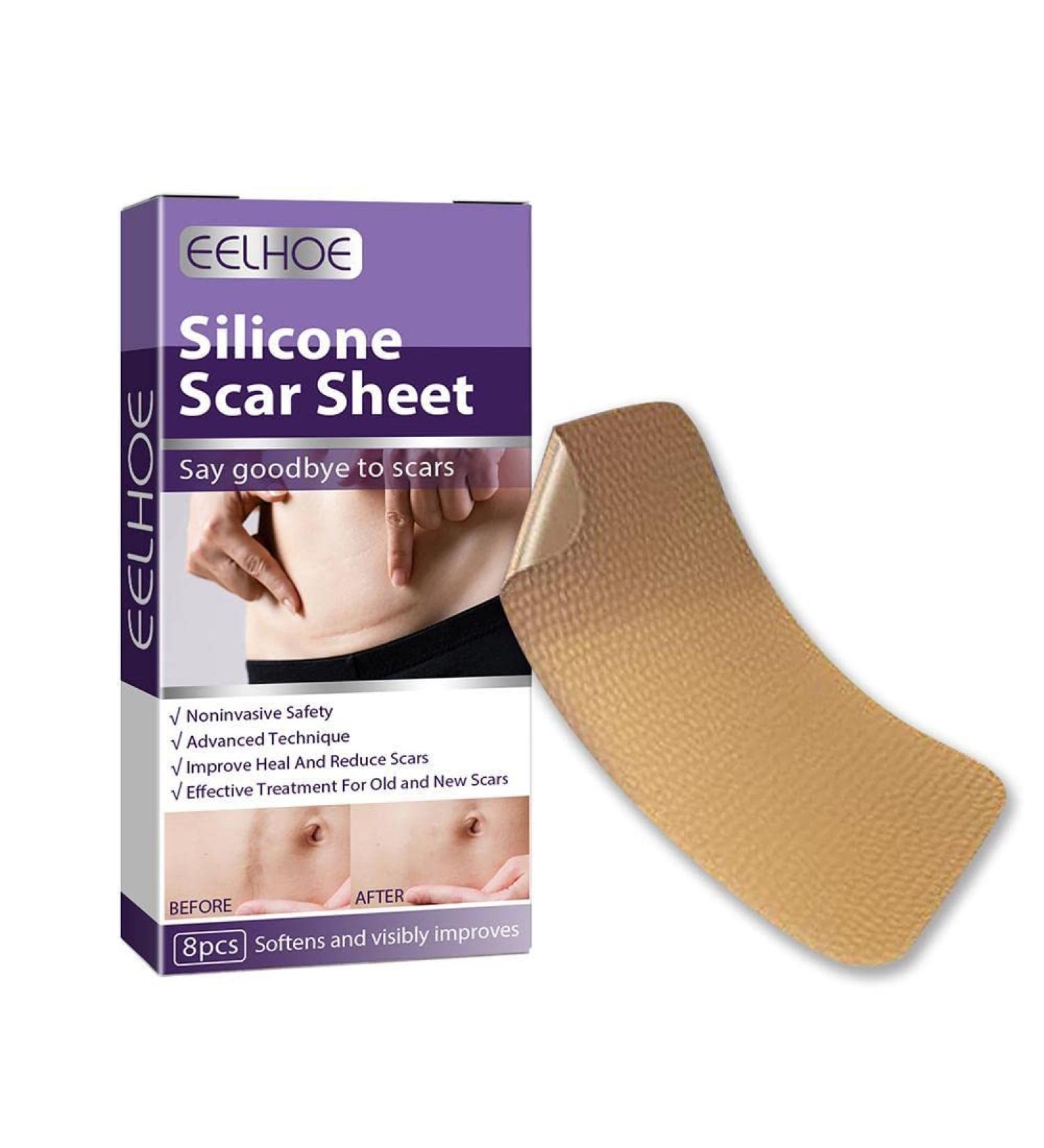 WAITLOVER Skin Color Reusable Silicone Scar Removal Patch - Surgical Self-Adhesive Soft Gel Strip for Burn Repair - Buy Online on GoSupps.com