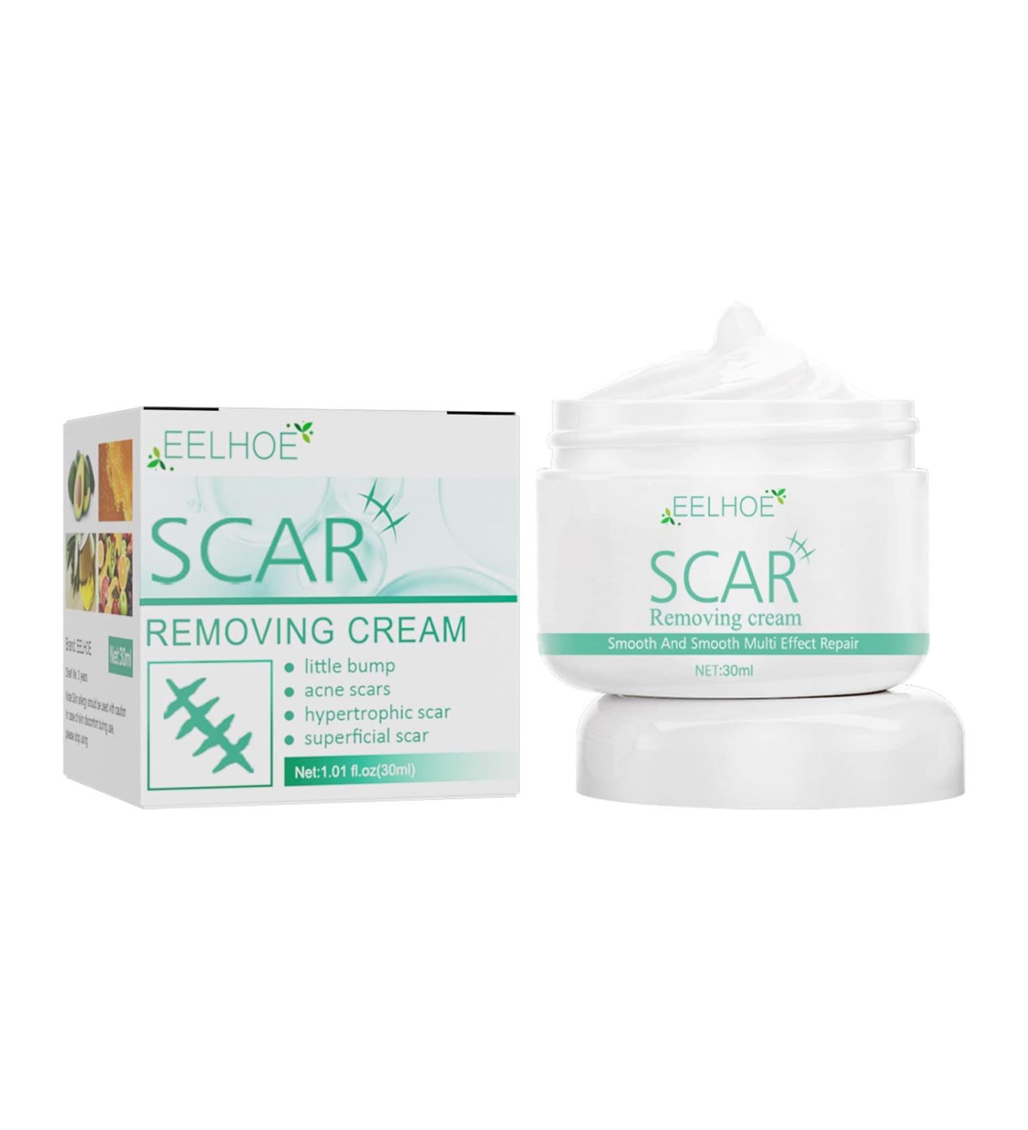 Scar Removal Cream for Old Stretch Marks & Burns - Men & Women - One Size - Buy Online on GoSupps.com