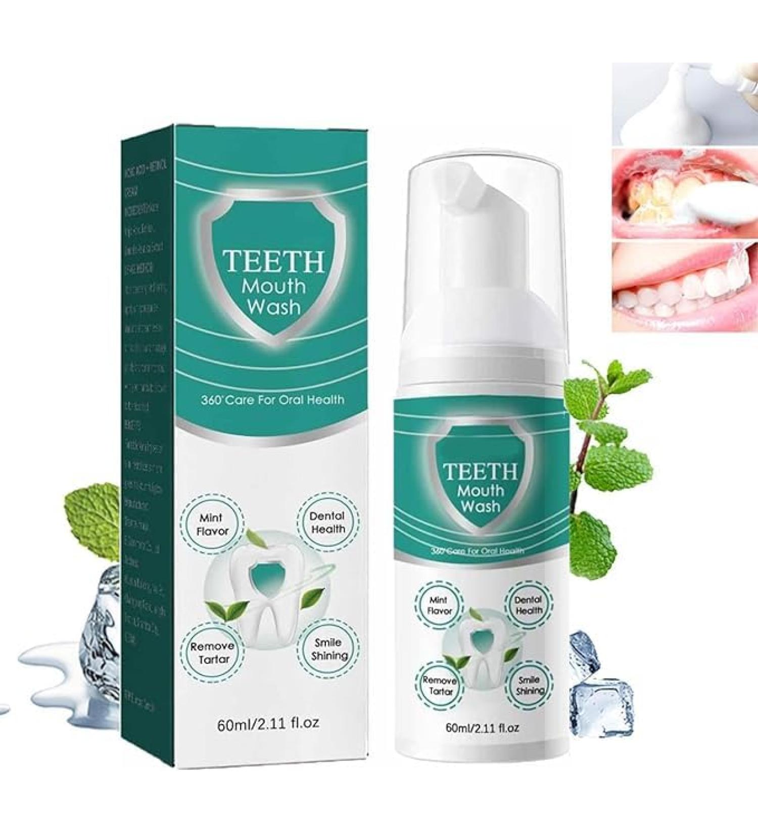 Teeth Total Care Mouthwash Teeth Mouthwash Teeth Mouth Wash - Solve All Oral Problems Mouthwash Whitening to Remove Tartar Freshen Breath Prevent Caries (1 Pcs) - Buy Online on GoSupps.com