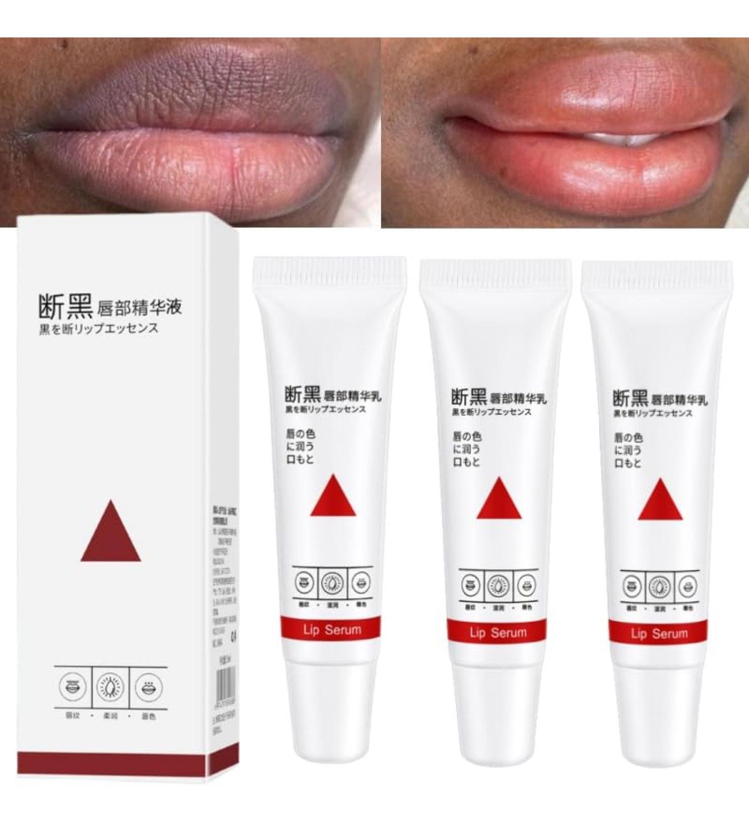 3Pcs Lip Balm for Dark Lips 15ml Fresh Pink Lip Balm Whitening Cream Lip Balm for Smokers Lip Balm for Men and Women - Buy Online on GoSupps.com