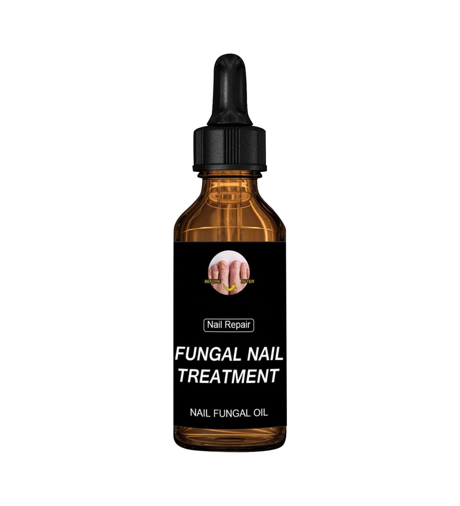 CAOQAO Nail Fix Solution Thickened Bright Nails To Get Rid Of Nail Dead Skin Fix Moisturizing Nail Nutrition Care Solution 30ml Nail Suction (B One Size) 1 count (Pack of 1) B - Buy Online on GoSupps.com