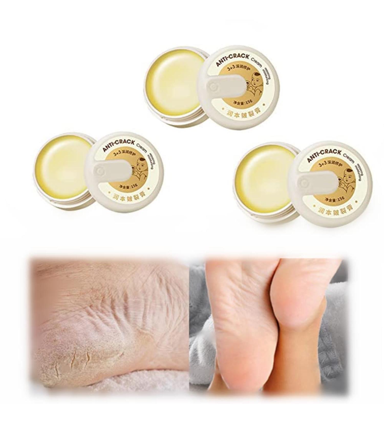 Yutingchby Natural Winter Foot Cream - 100% Moisturizing Anti-Cracking Solution for Rough Dry and Cracked Hands - Buy Online on GoSupps.com