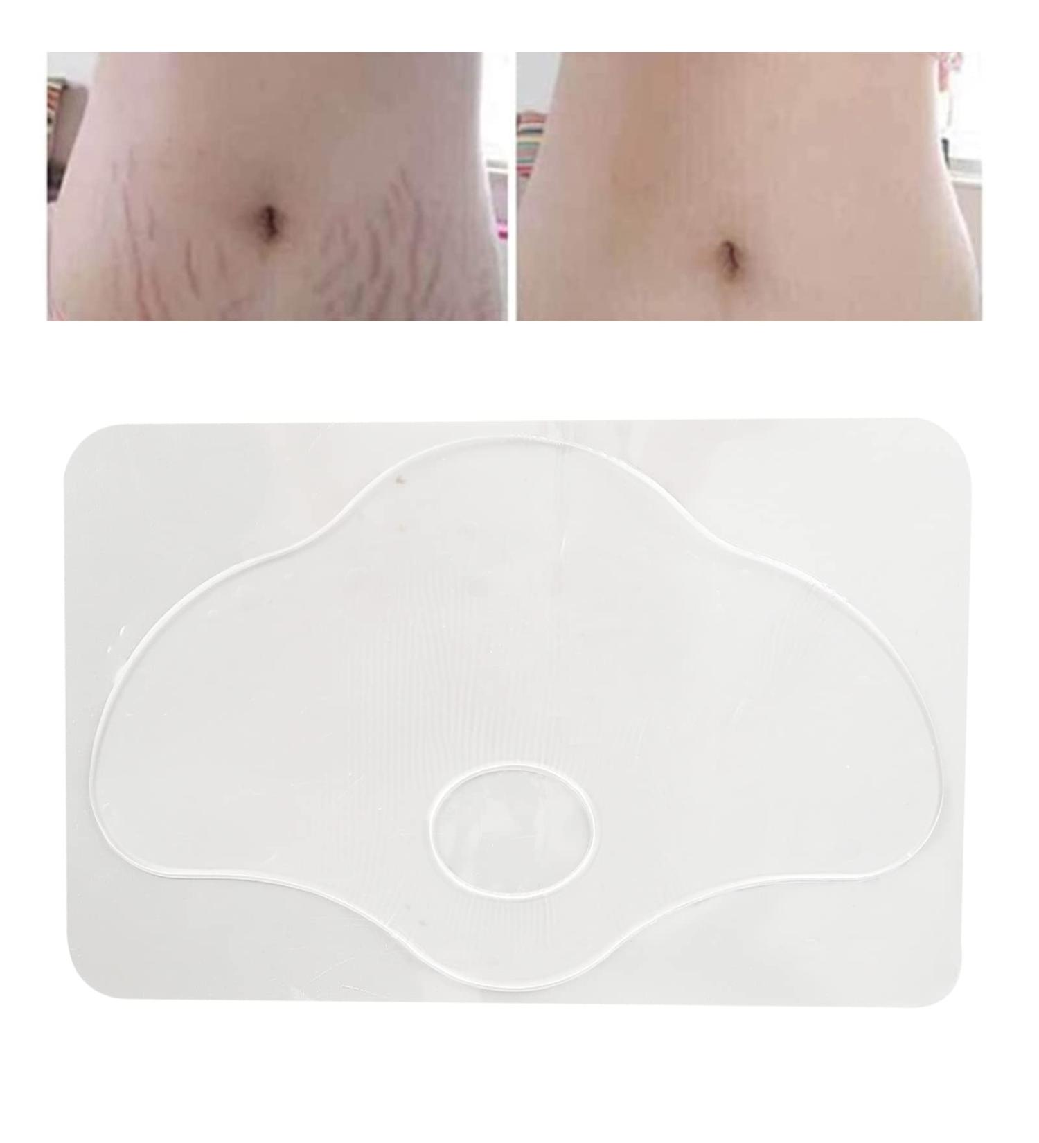 Silicone Scar Sheets - Reusable Stretch Mark & Wound Healing Patches - Buy Online on GoSupps.com