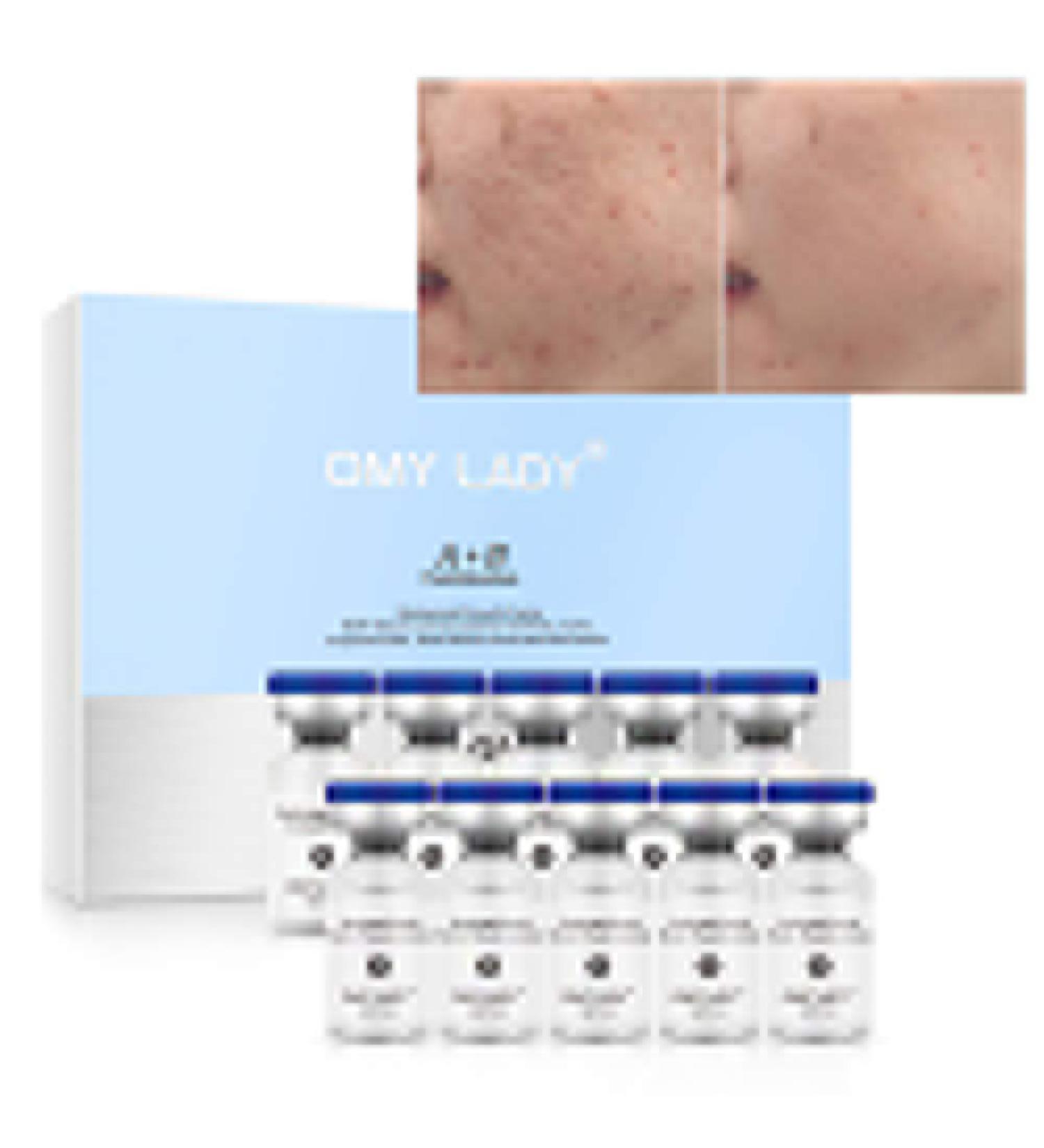 EGF Skin Rejuvenation Serum & Growth Factor Powder Kit | Moisturizing, Anti-Wrinkle & Pigmentation Treatment | Acne Scar Repair Facial Serum - Buy Online on GoSupps.com