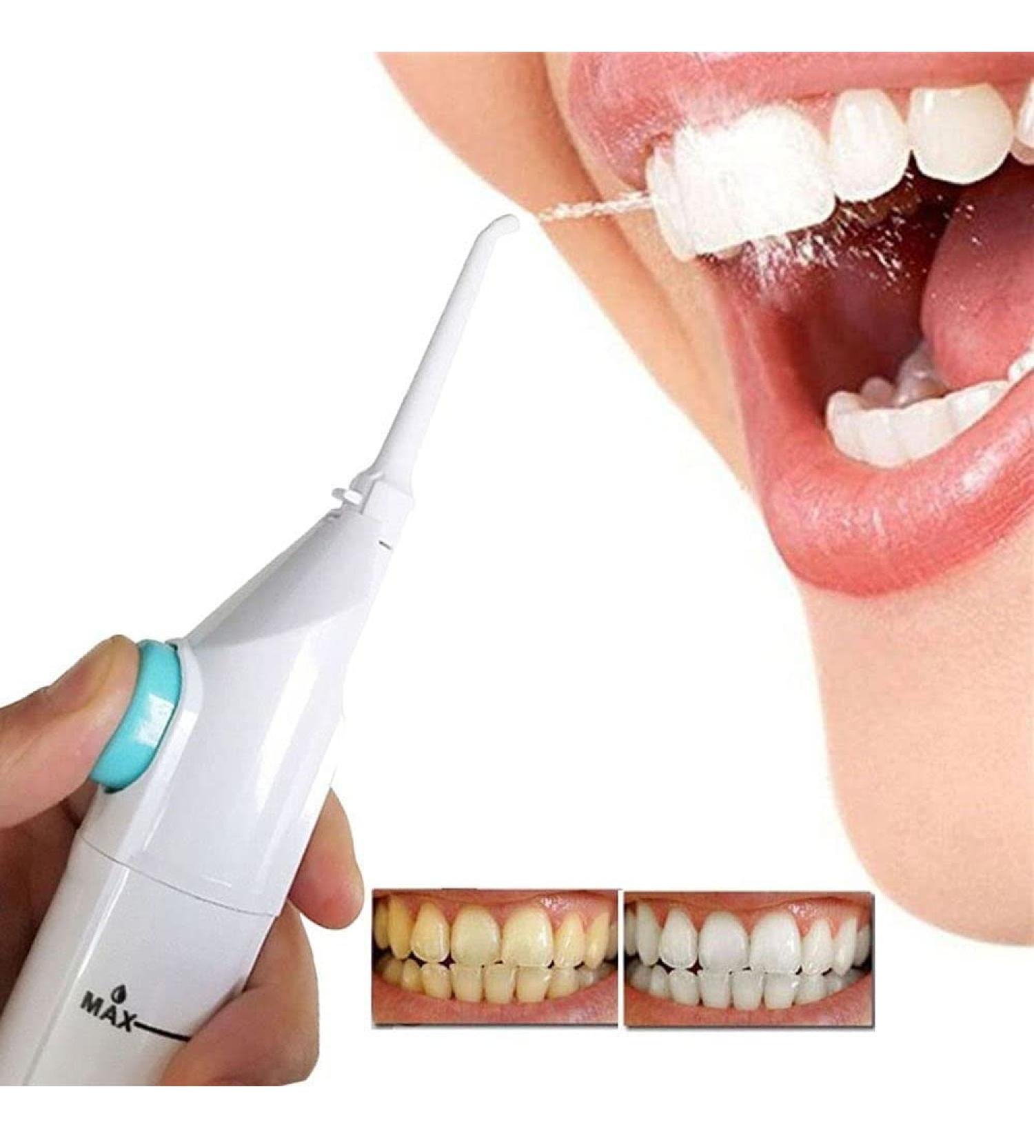 Portable Dental Water Jet - Air Powered Flosser for Teeth Cleaning | No Batteries or Cords - Ideal for Tooth Crevices & Dental Care - Buy Online on GoSupps.com