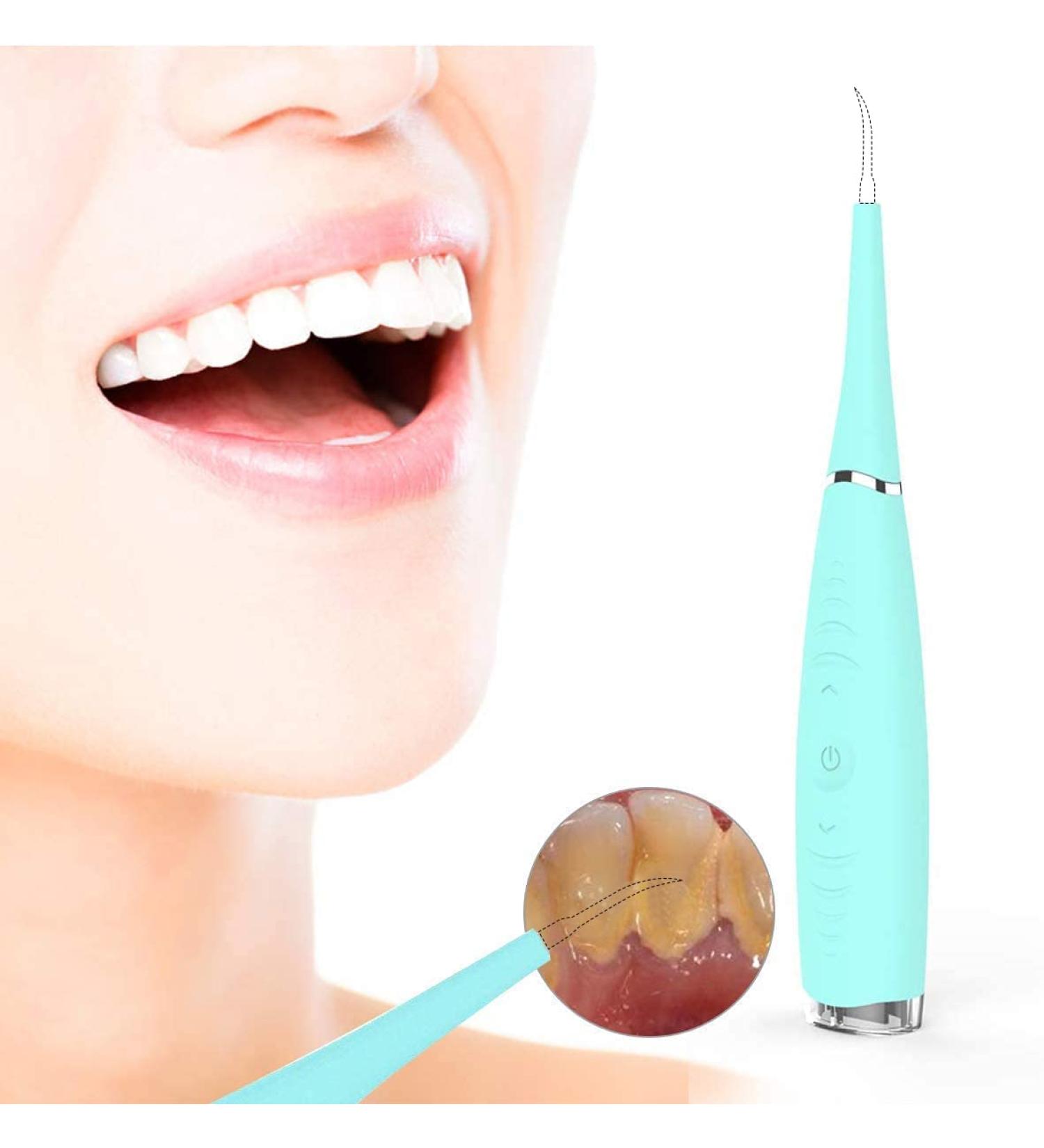 Teeth Cleaning Kit - Plaque Remover, Calculus Remover, Stain Removal - Blue Teeth Cleaning Tools - Buy Online on GoSupps.com