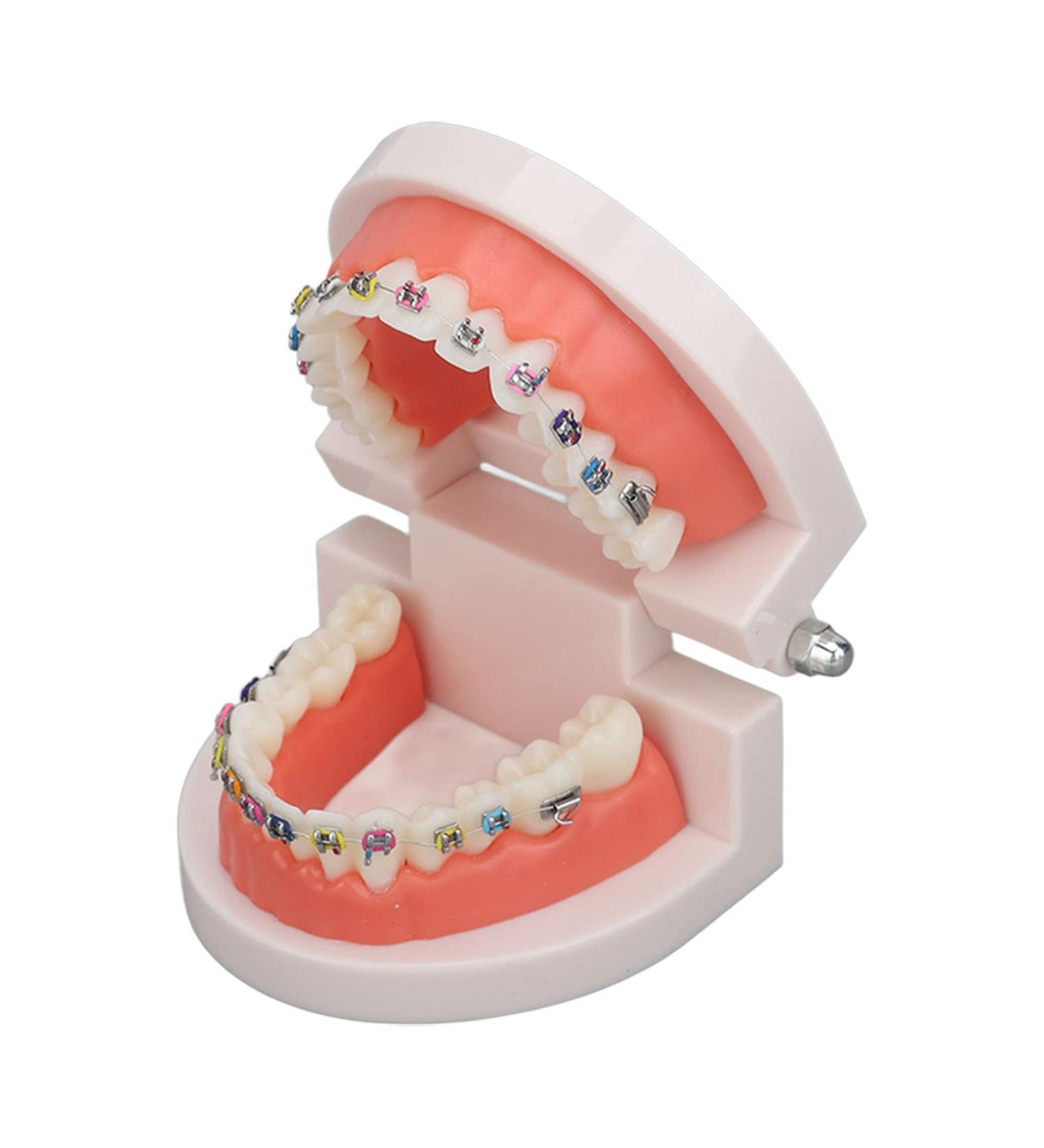 ANGGREK Dental Typodontic Tooth Model with Orthodontic Metal Mount | Ideal for Teaching & Research - International Shipping Available - Buy Online on GoSupps.com
