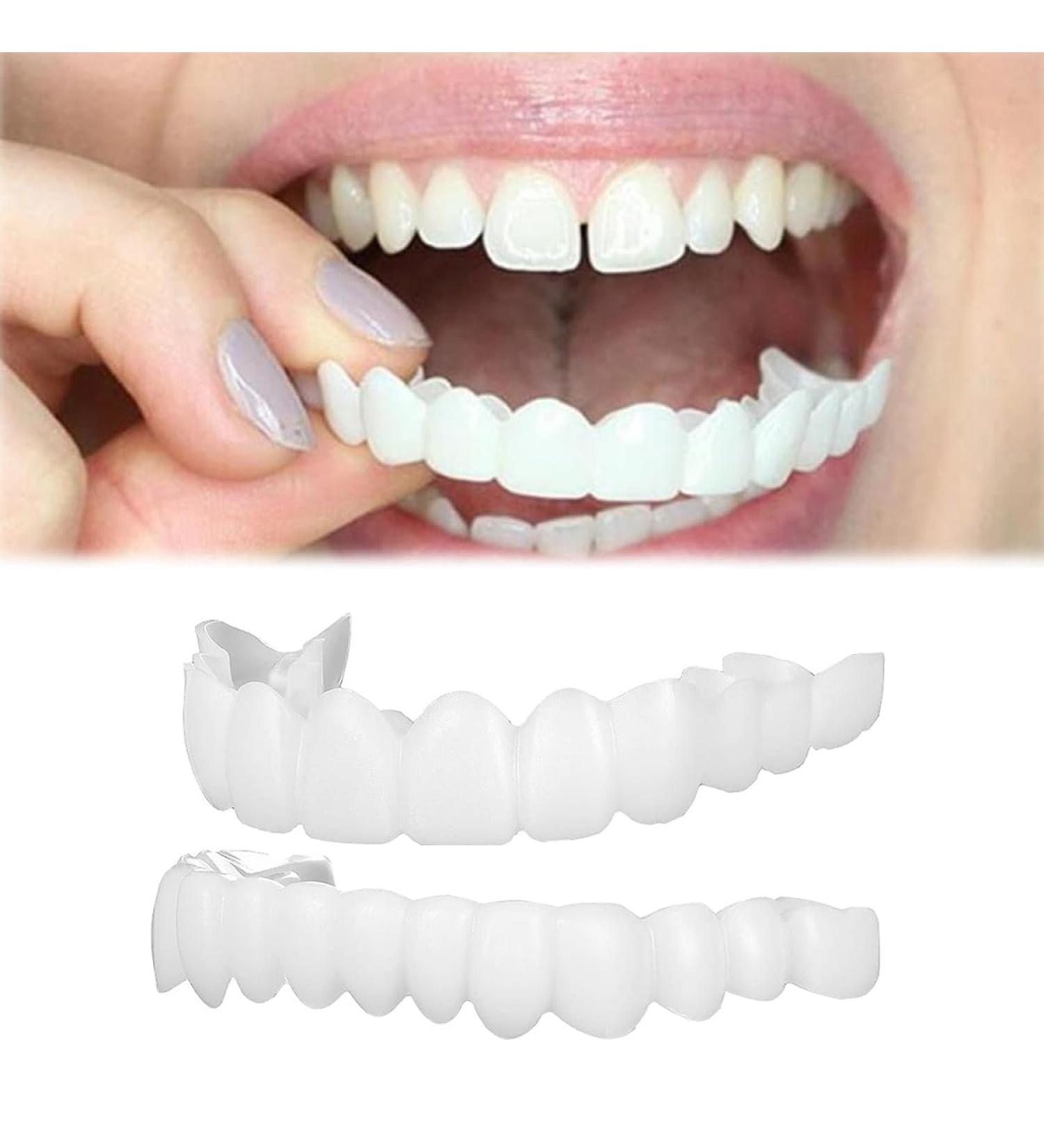 Dazzluxe Instant Veiners - 2 Pairs Cosmetic Lightening Teeth Clip-Ins for Men & Women | Enhance Your Smile! - Buy Online on GoSupps.com