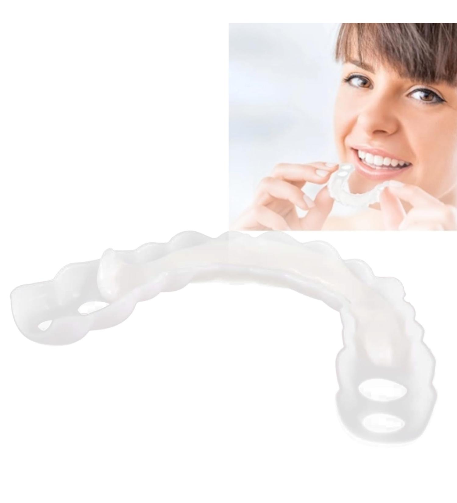 Pack of Easy-to-Clean White Artificial Braces - Top & Bottom Instant Veneers for Instant Confidence | International Shipping Available - Buy Online on GoSupps.com