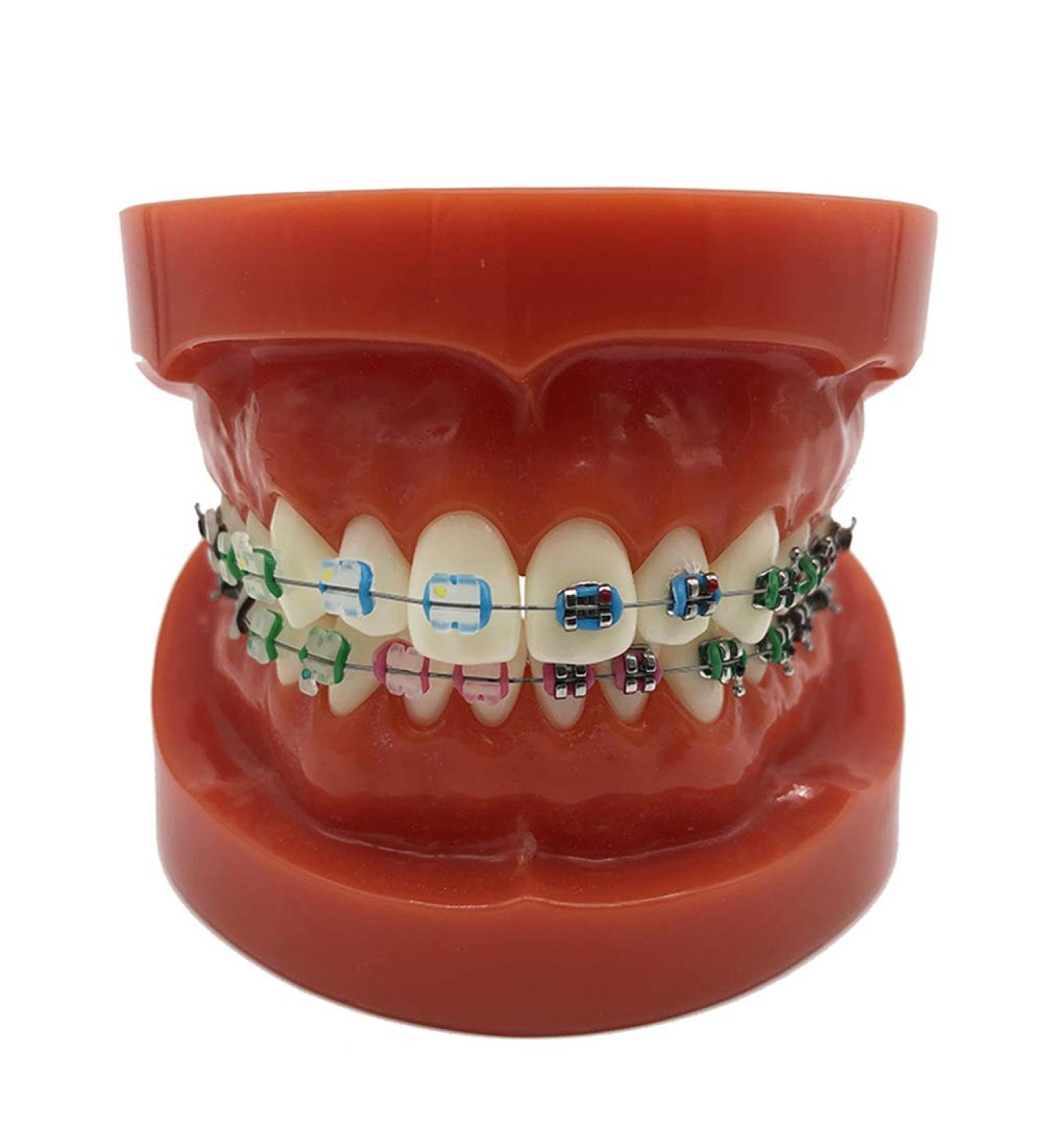 ERNZI Typodont Teeth Model | Dental Orthodontic Demonstration for Science Teaching | International Shipping Available - Buy Online on GoSupps.com