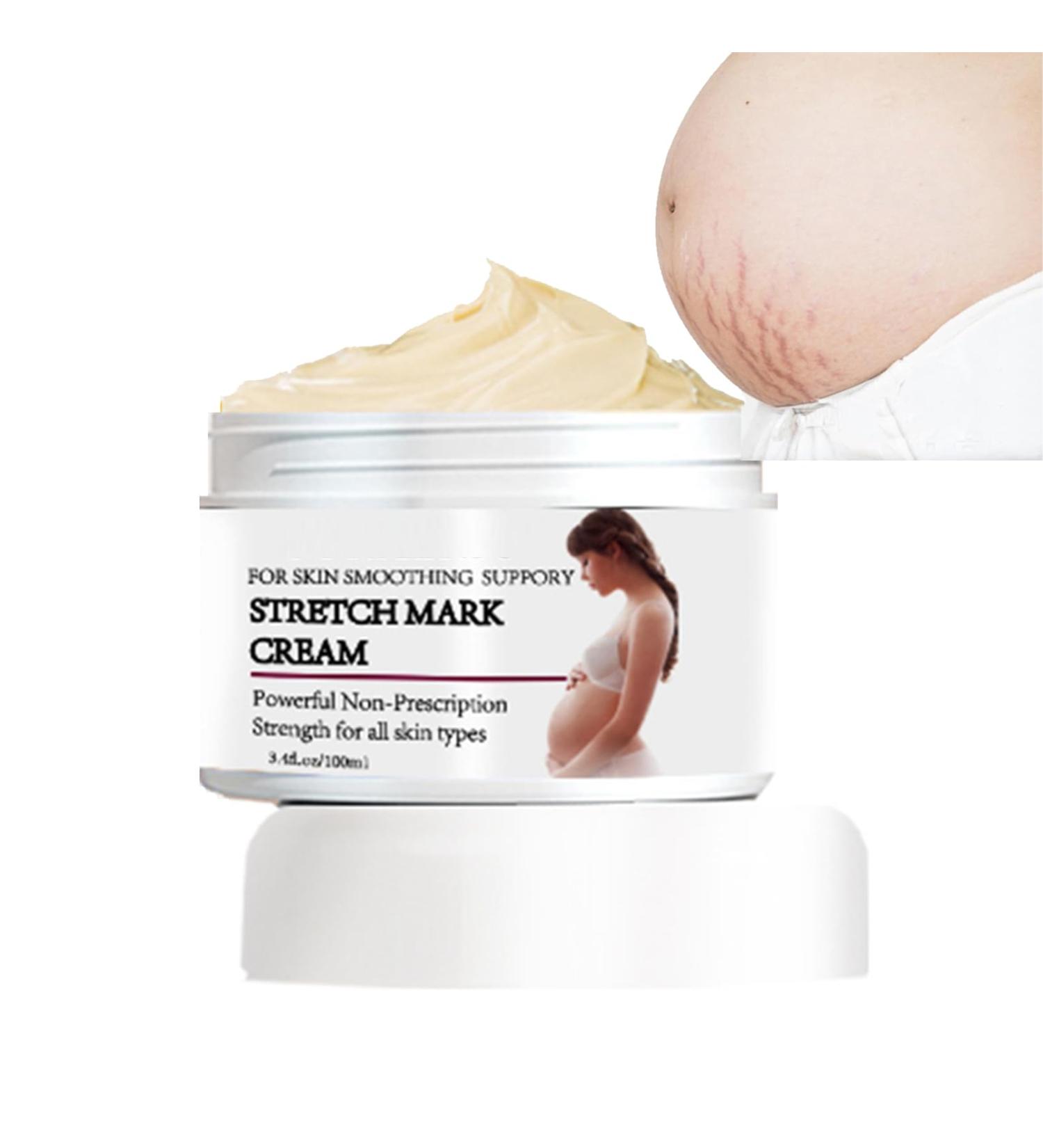 Stretch Marks Cream & Pregnancy Massage Body Butter - 100ml Shea Butter Formula for Reducing & Preventing Stretch Stripes - Buy Online on GoSupps.com