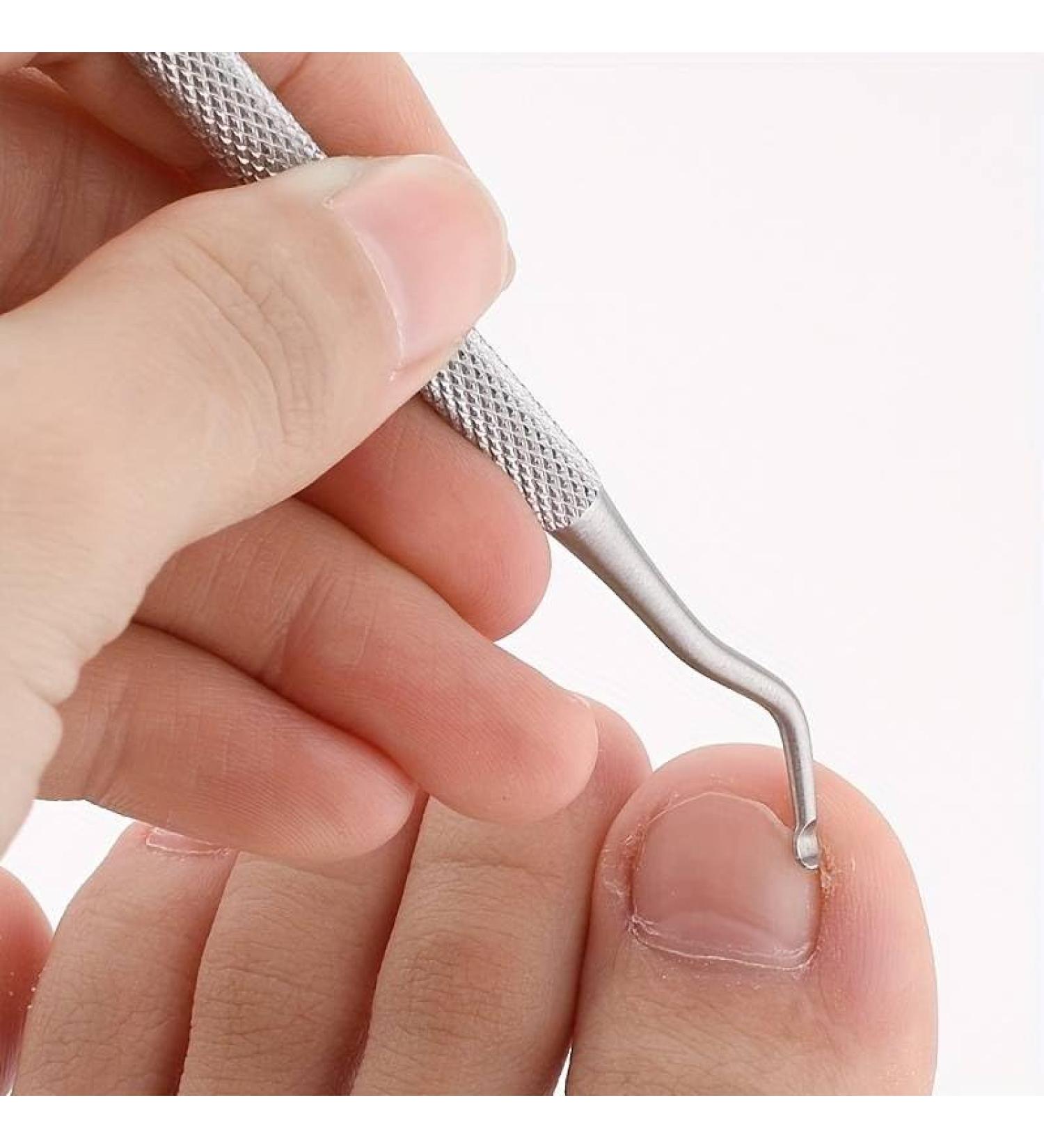 Ingrown Toe Nail File Lifter Kit INGROWN SIDE EDGES