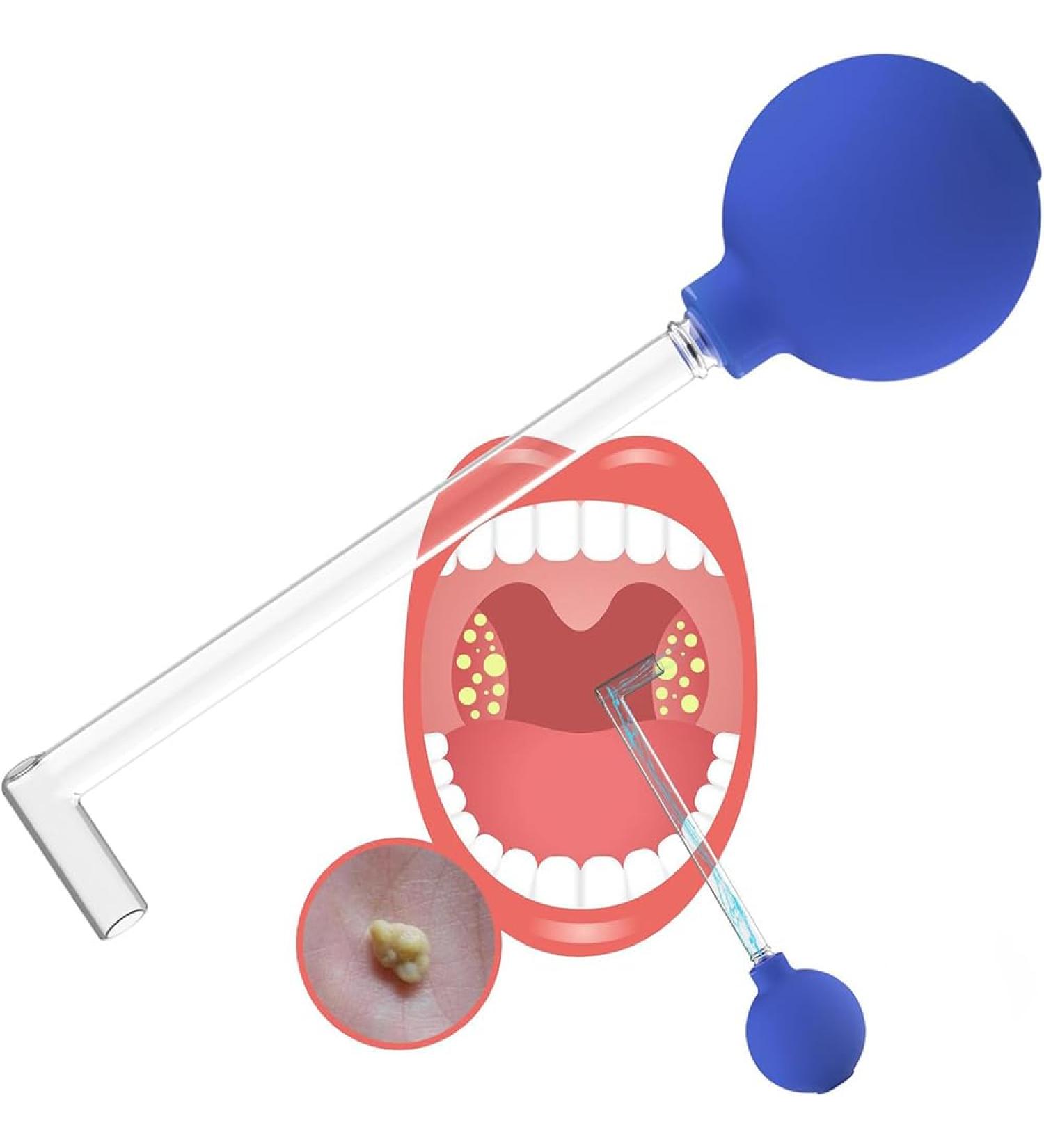 Gerrit Tonsillenstein: Effective Tonsil Stone Remover Tools for Bad Breath - Almond Stones Cupping Glass for Mouth Cleaning | International Shipping Available - Buy Online on GoSupps.com