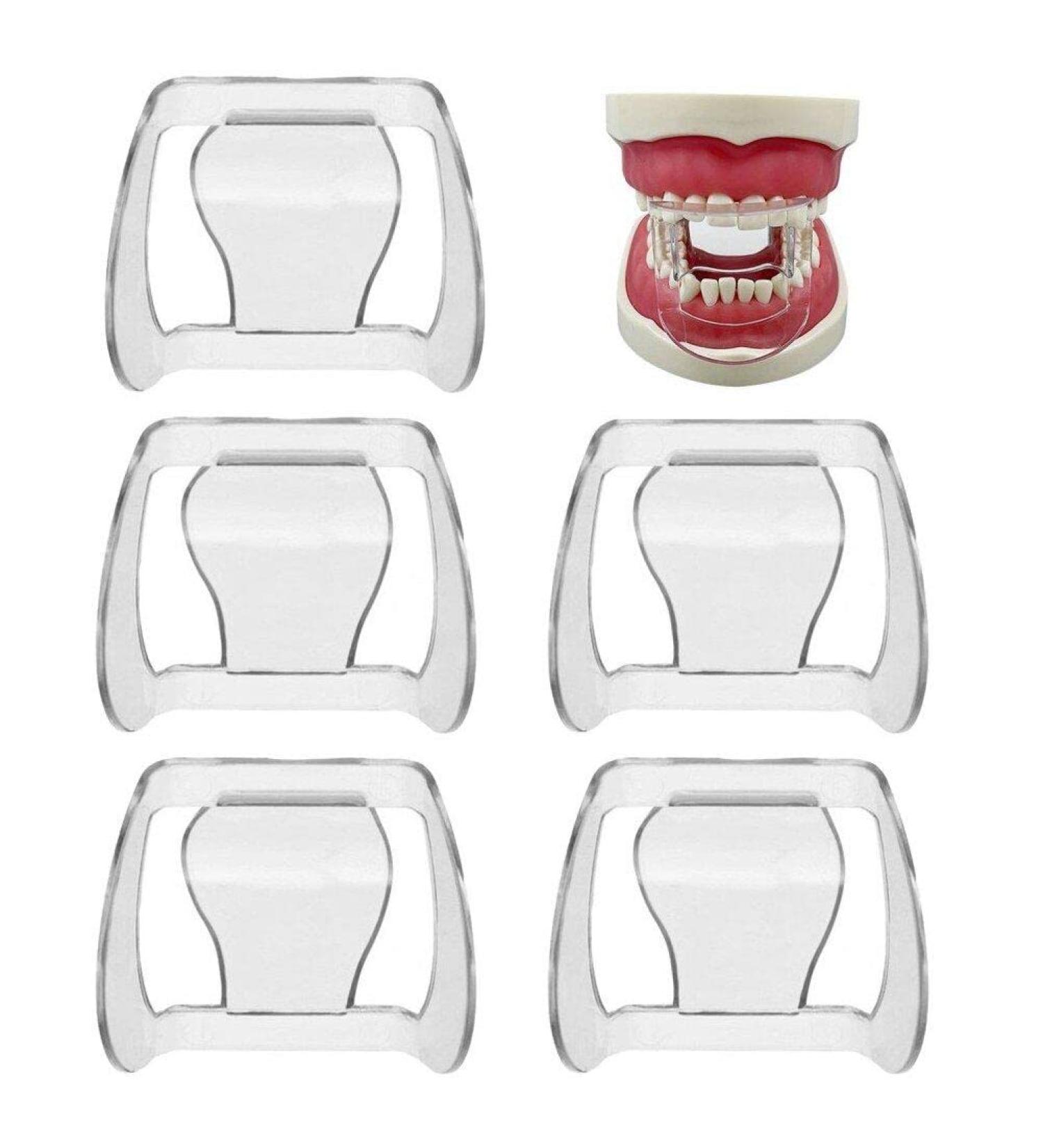 5pcs Clear Tooth Orthodontics Lip Cheek Retractor - Mouth Opener for Front Teeth | International Shipping - Buy Online on GoSupps.com
