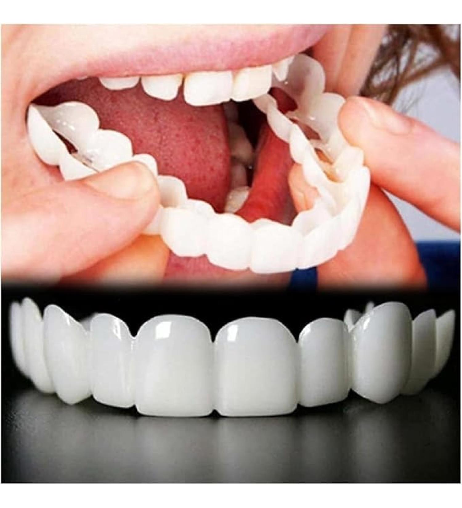 2 Pairs Temporary Nature and Comfortable Adjustable for Men and Women Beautiful Smile(White) (6) - Buy Online on GoSupps.com