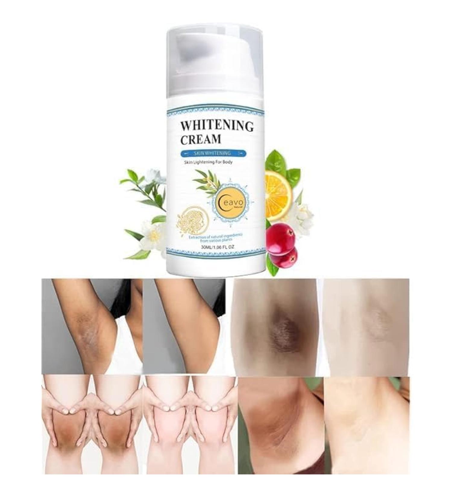 Buy Skin Bleaching Cream for Body & Intimate Areas | Skin Whitening & Lightening Cream for Underarms Knees Elbows & Bikinis - International Shipping Available - Buy Online on GoSupps.com