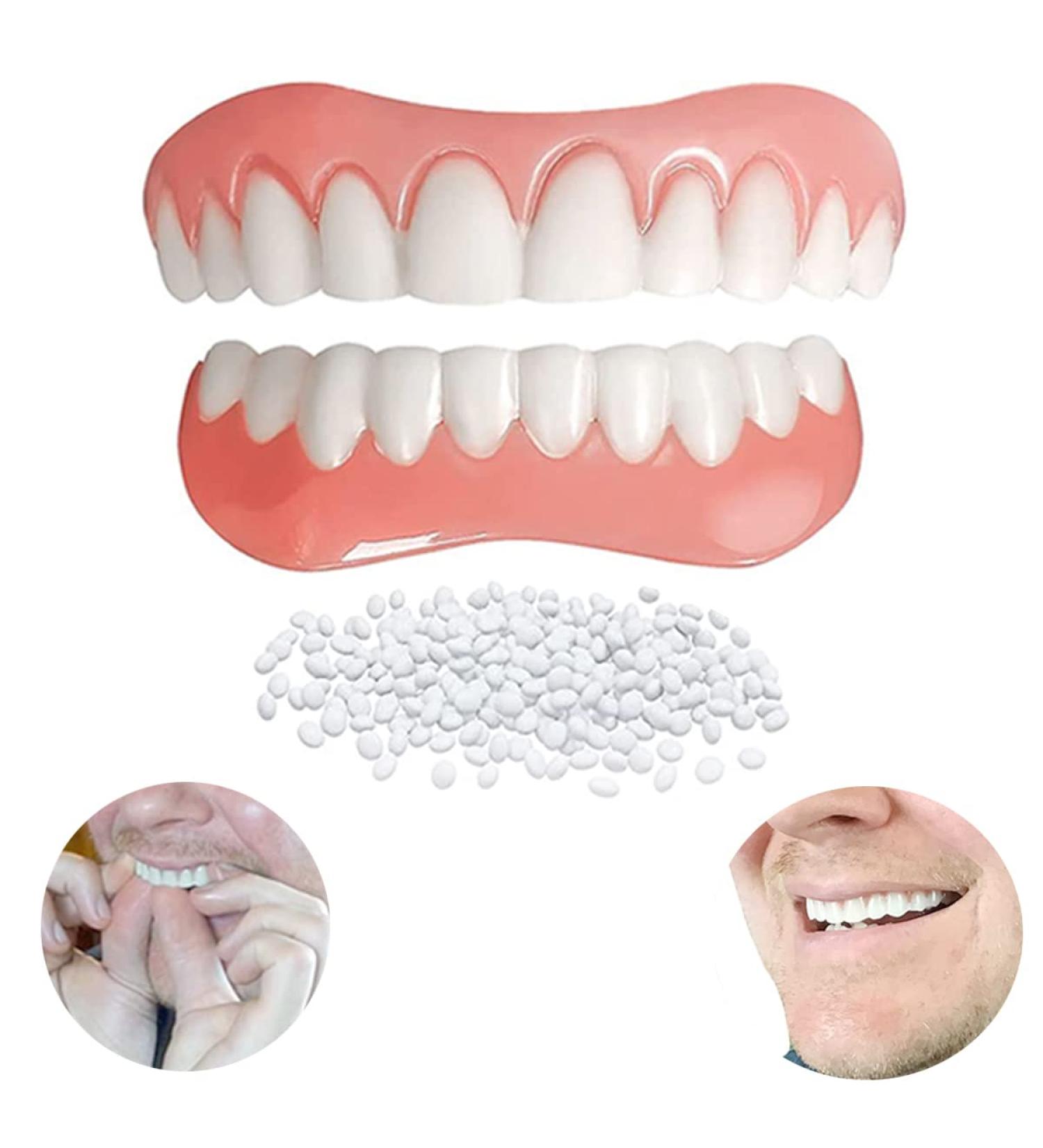 Instant Fake Teeth Dental Veneers - Upper & Lower Jaw Dentures Repair Kit for Temporary Tooth Restoration - Fix Your Smile At Home in Minutes! - Buy Online on GoSupps.com