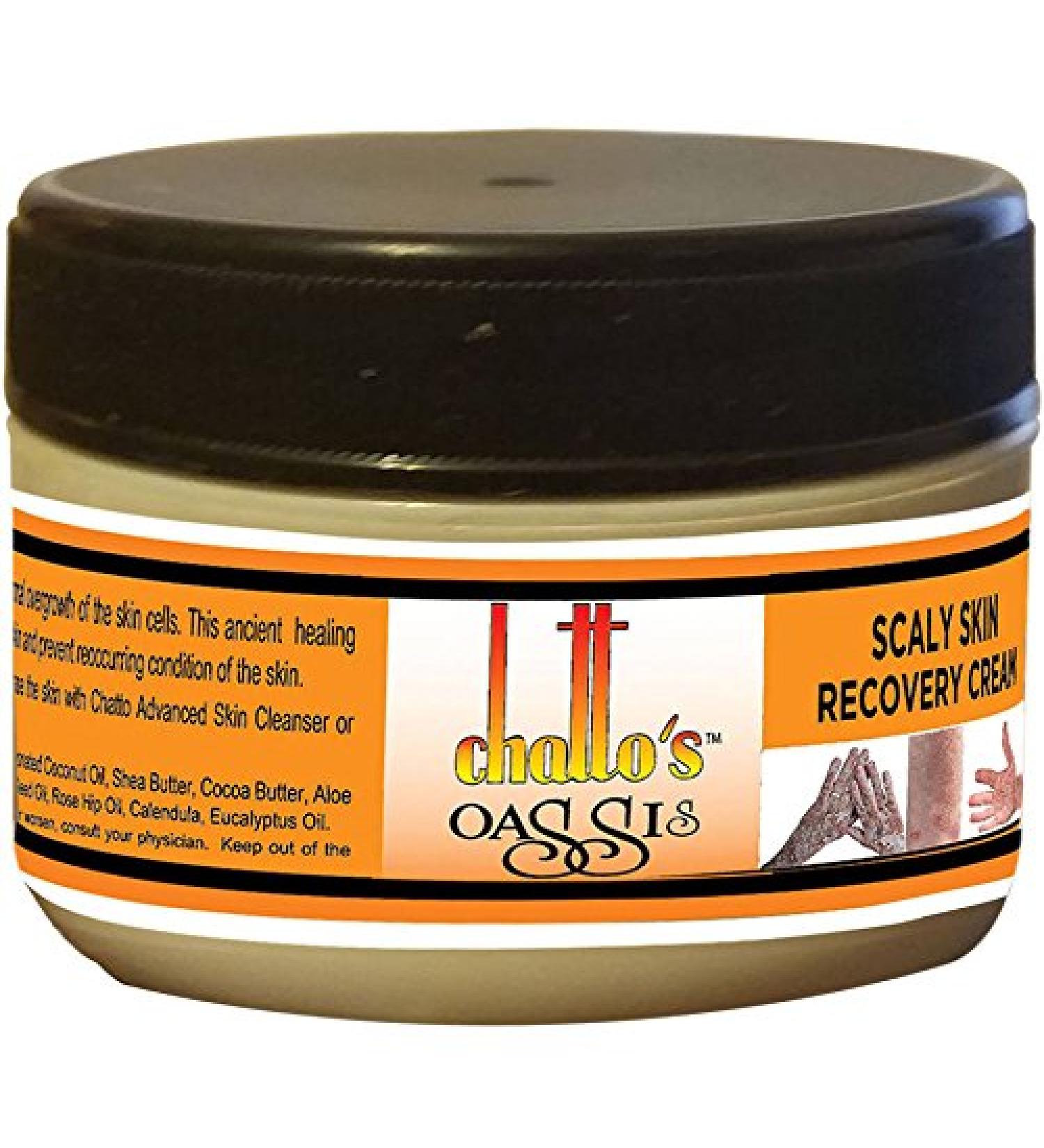 Organic Dry Scaly Skin Recovery Cream