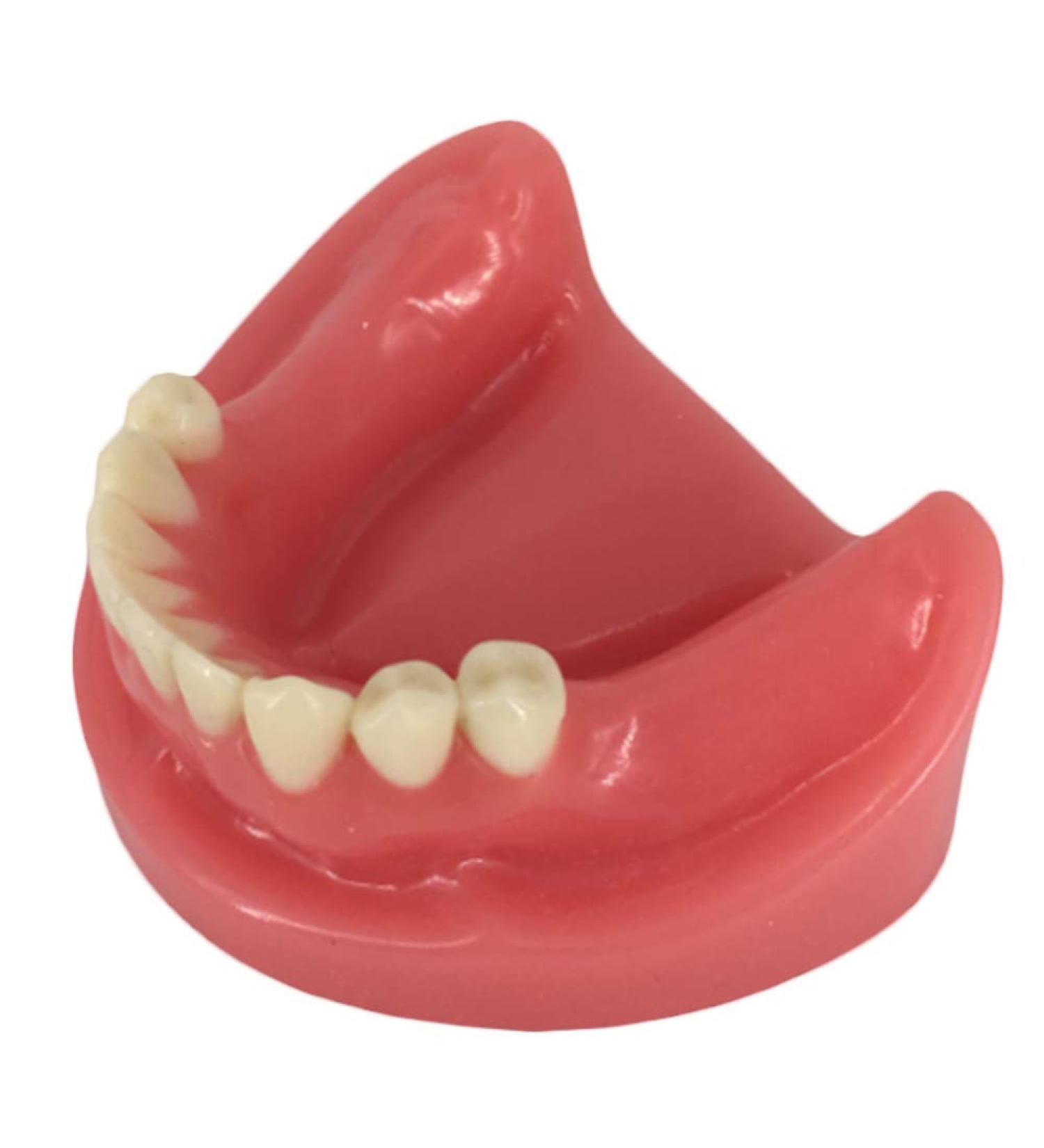 Fhuili Dental Lower Jaw Teeth Missing Model - 9 Teeth Oral Simulation for Study - Realistic Gum Dental Demo - Buy Online on GoSupps.com