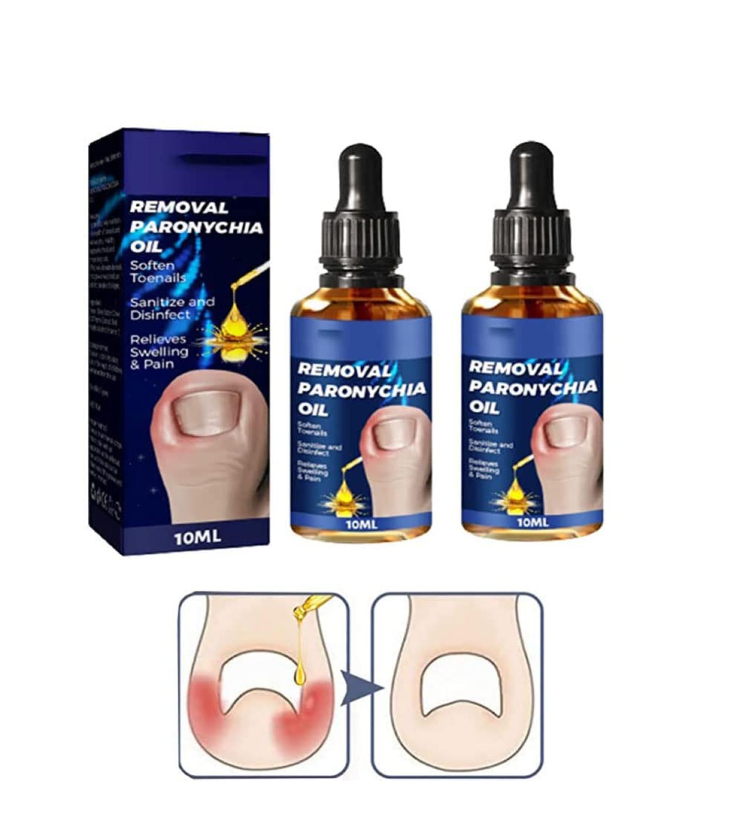  LWuuywa German Toenailplus Anti-Paronychia Relief Oil 10ml Correction Treatment Oil Nail Care Nail Growing Anti-Paronychia Aid Oil Ingrown Nail Drops - Buy Online on GoSupps.com