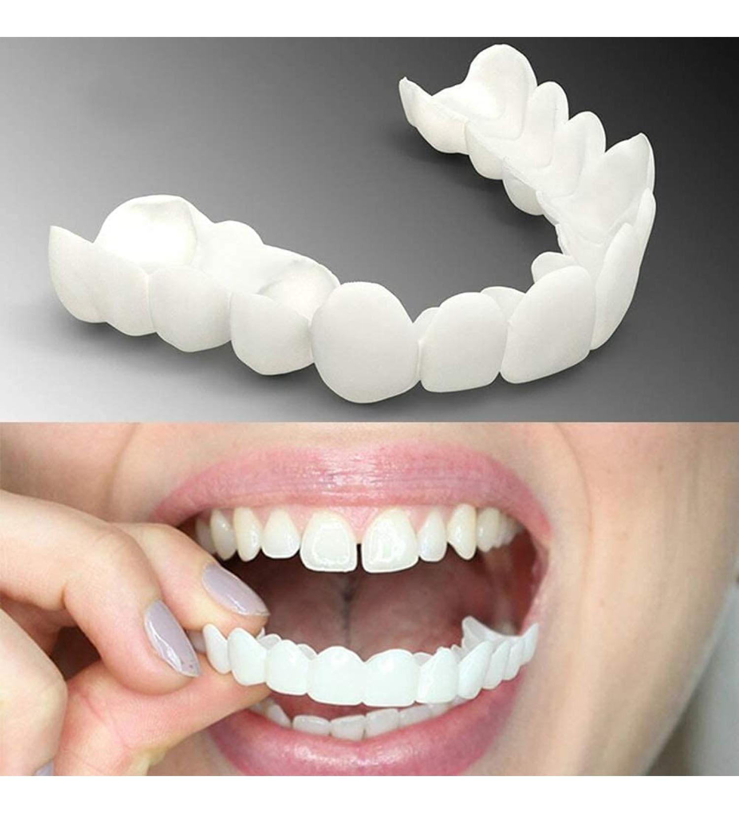 Brigtviee Instant Veneers: Upper & Lower Teeth Whitening | Adjustable, Comfort Fit Snap-On Dentures - 2 Pairs - Buy Online on GoSupps.com