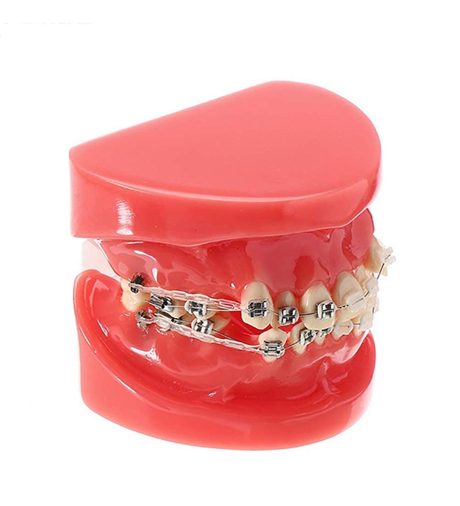 Buy Model Doll-10 Orthodontic Braces for Adults | Ceramic Demonstration Teeth | Mobile Medical Science & Teaching Research - Buy Online on GoSupps.com