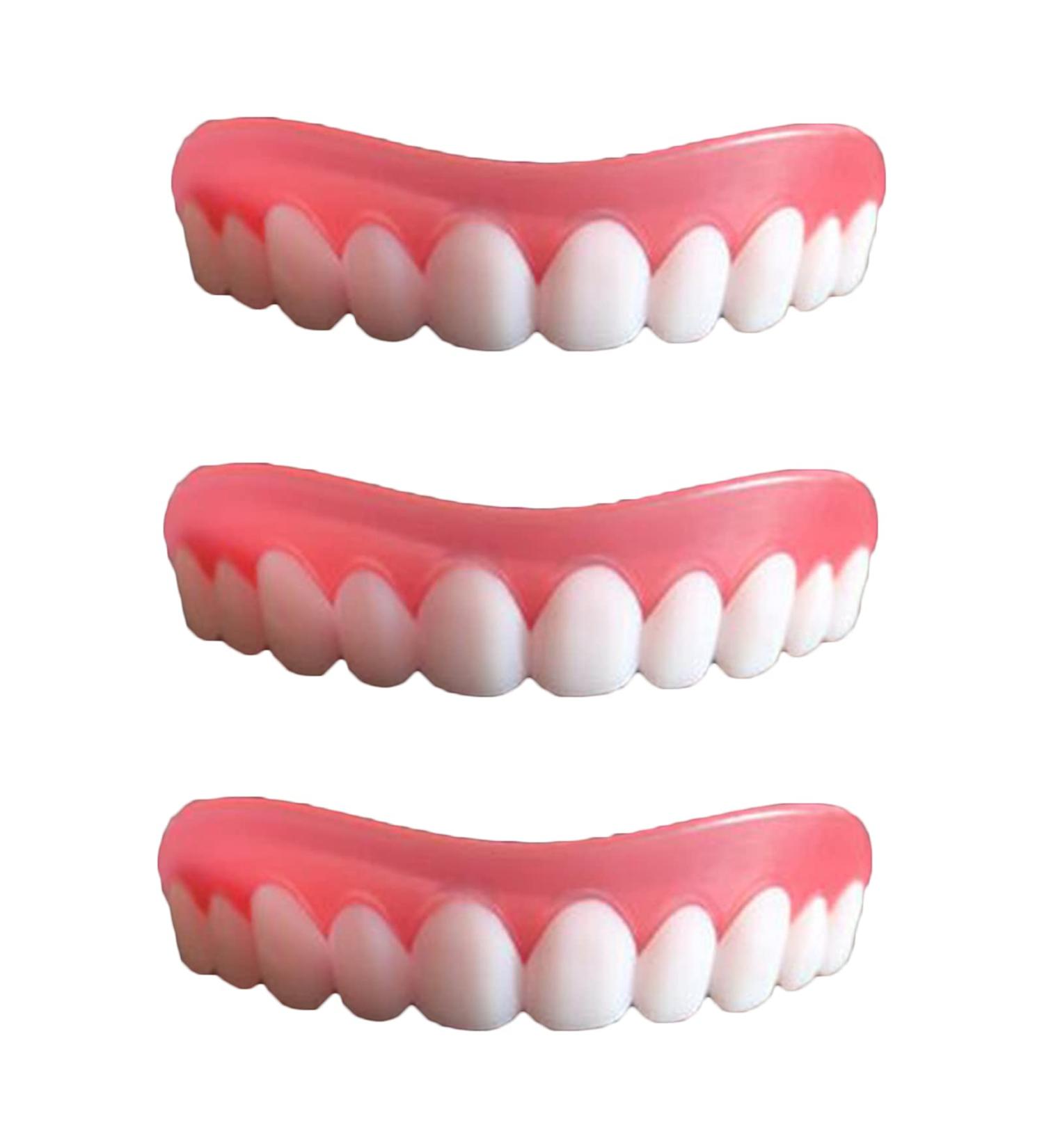 Professional Upper White Teeth Braces - 3 Piece Veneer Set for a Perfect Smile - International Shipping Available - Buy Online on GoSupps.com