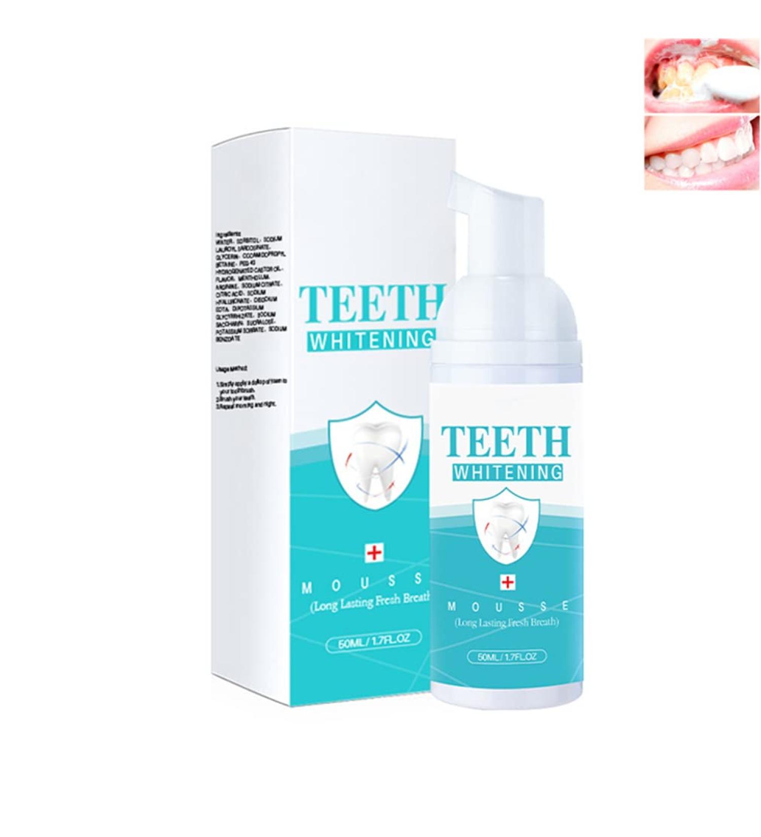 Ultra-fine Mousse Whitening Toothpaste Foam Teeth Whitening Foam Toothpaste Baking Soda Toothpaste Intensive Stain Removal Toothpaste Toothpaste Replacement Ultra-fine Mousse Foam (1) - Buy Online on GoSupps.com