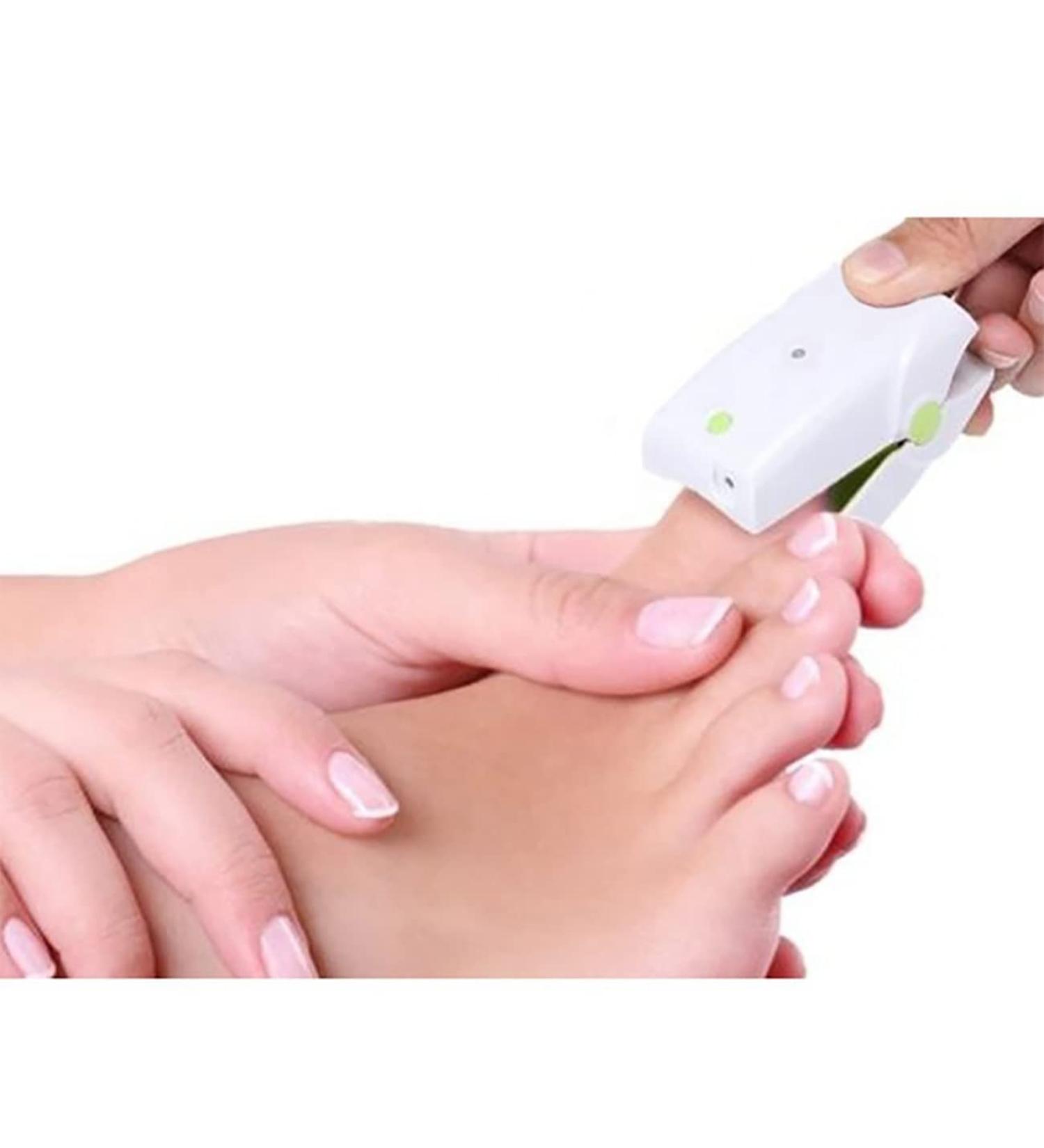 Nail Fungus Treatment Device | Portable Onychomycosis Cleaning Device | Rechargeable for Fingernails & Toenails | Painless Cure at Home - Buy Online on GoSupps.com