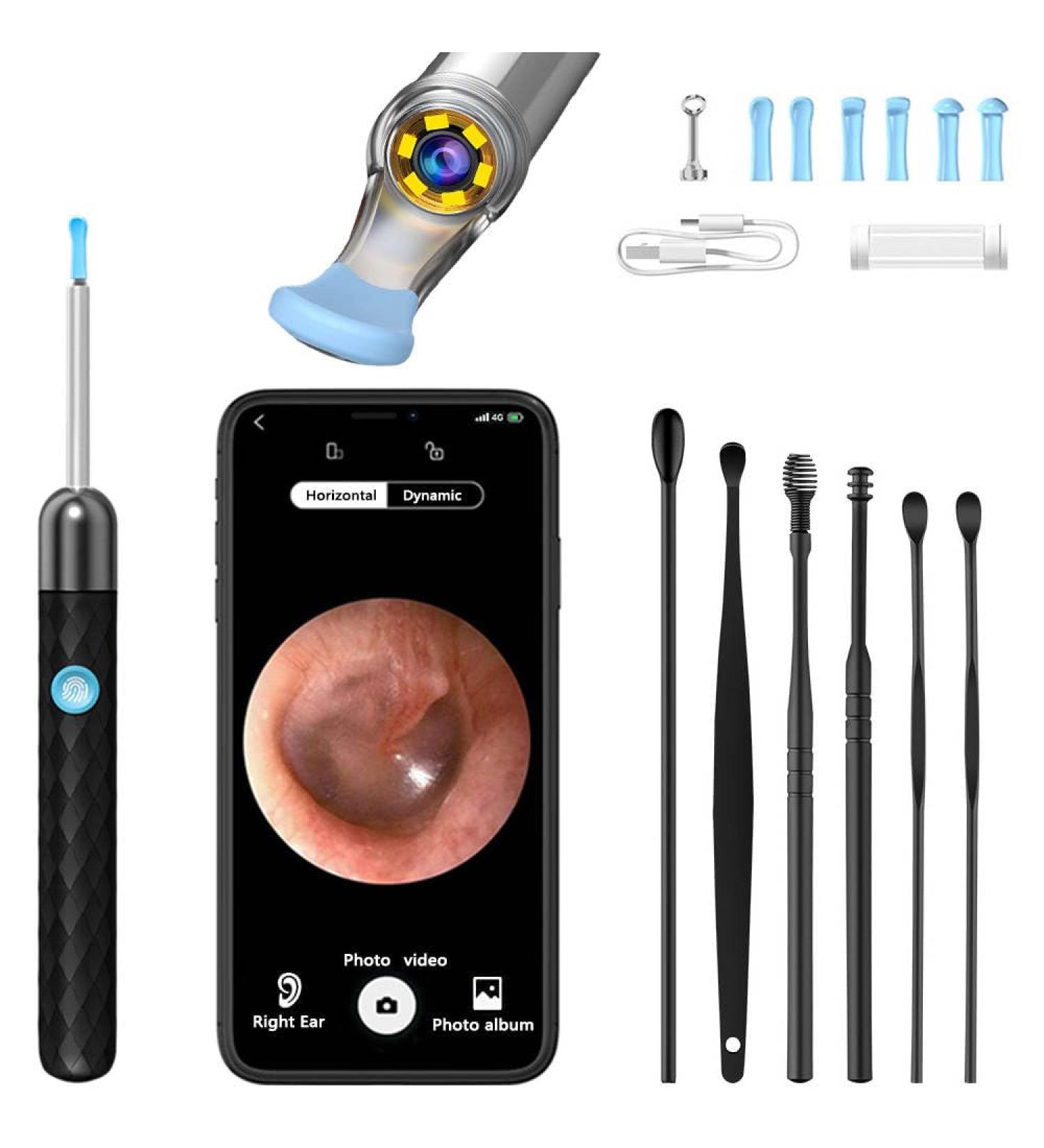 AROSKY Ear Wax Removal Kit - 1920P HD Ear Camera with Light | Soft Silicone Tips for Safe Ear Cleaning | Effective Ear Wax Cleaner Tool - Buy Online on GoSupps.com