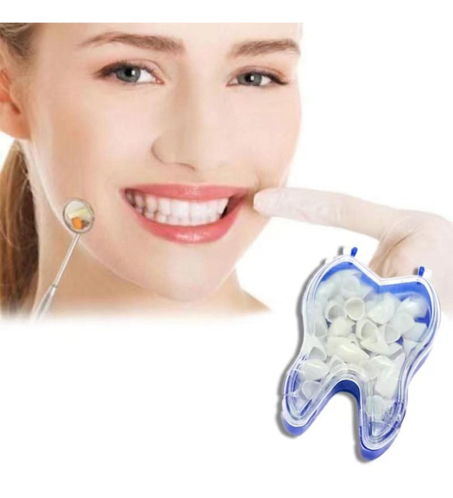 Generic Teeth Beauty Solution - Portable Upper Teeth Repair & Brightening | Reshape & Fix Broken Teeth Easily - Buy Online on GoSupps.com