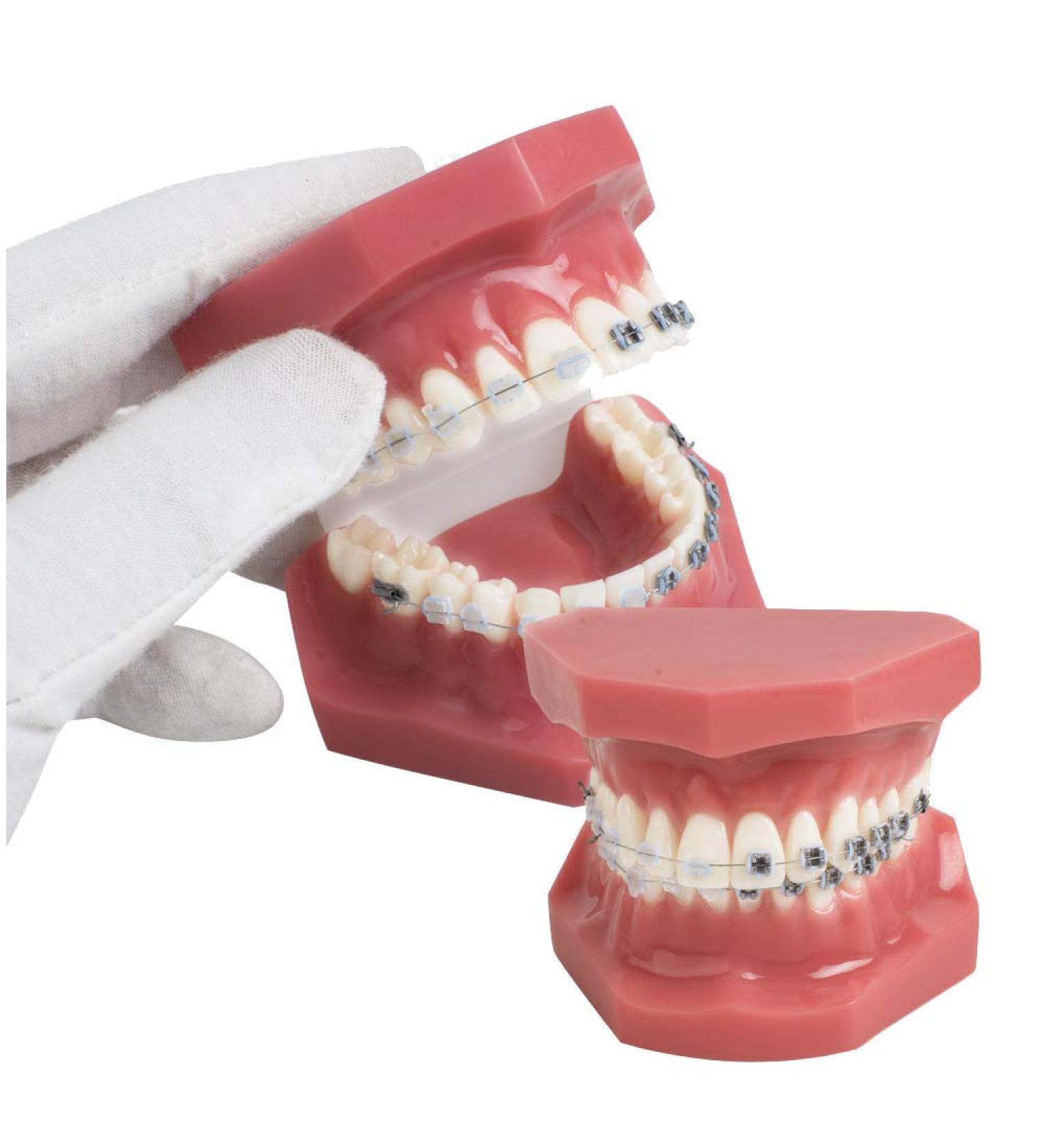 Dental Teeth Model - Orthodontic Study Tool with Metal & Ceramic for Demonstration - Buy Online on GoSupps.com