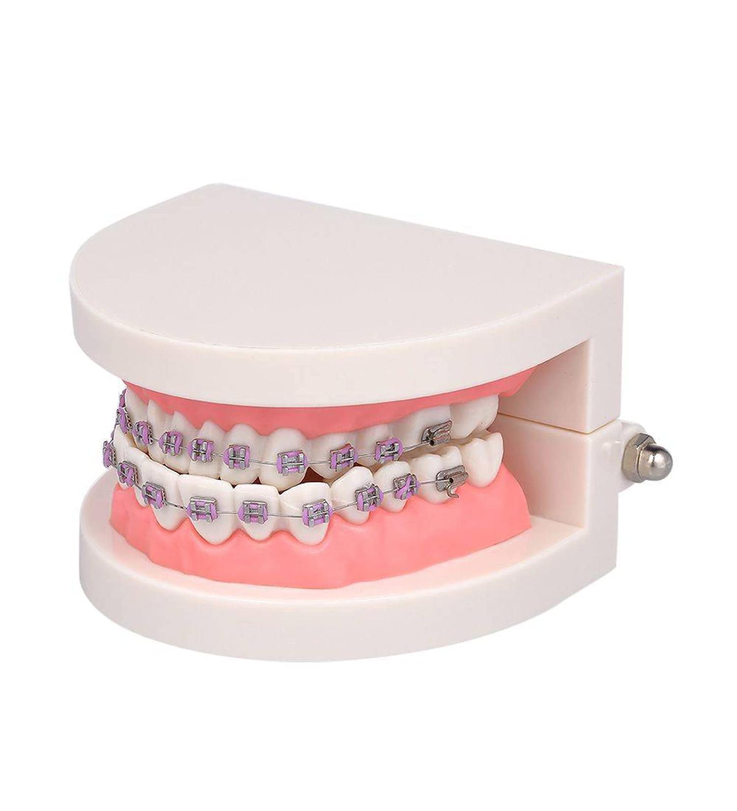 Dytah Orthodontic Demonstration Model - Teeth Study Model with Metal Arch Wire & Brackets for Effective Teaching - Buy Online on GoSupps.com