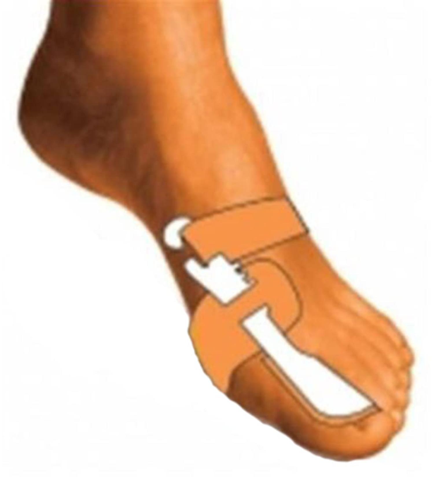 Buy Orione OK PED Safe Night Corrector for Hallux Valgus (Small 36-40 Left) - International Shipping Available - Buy Online on GoSupps.com
