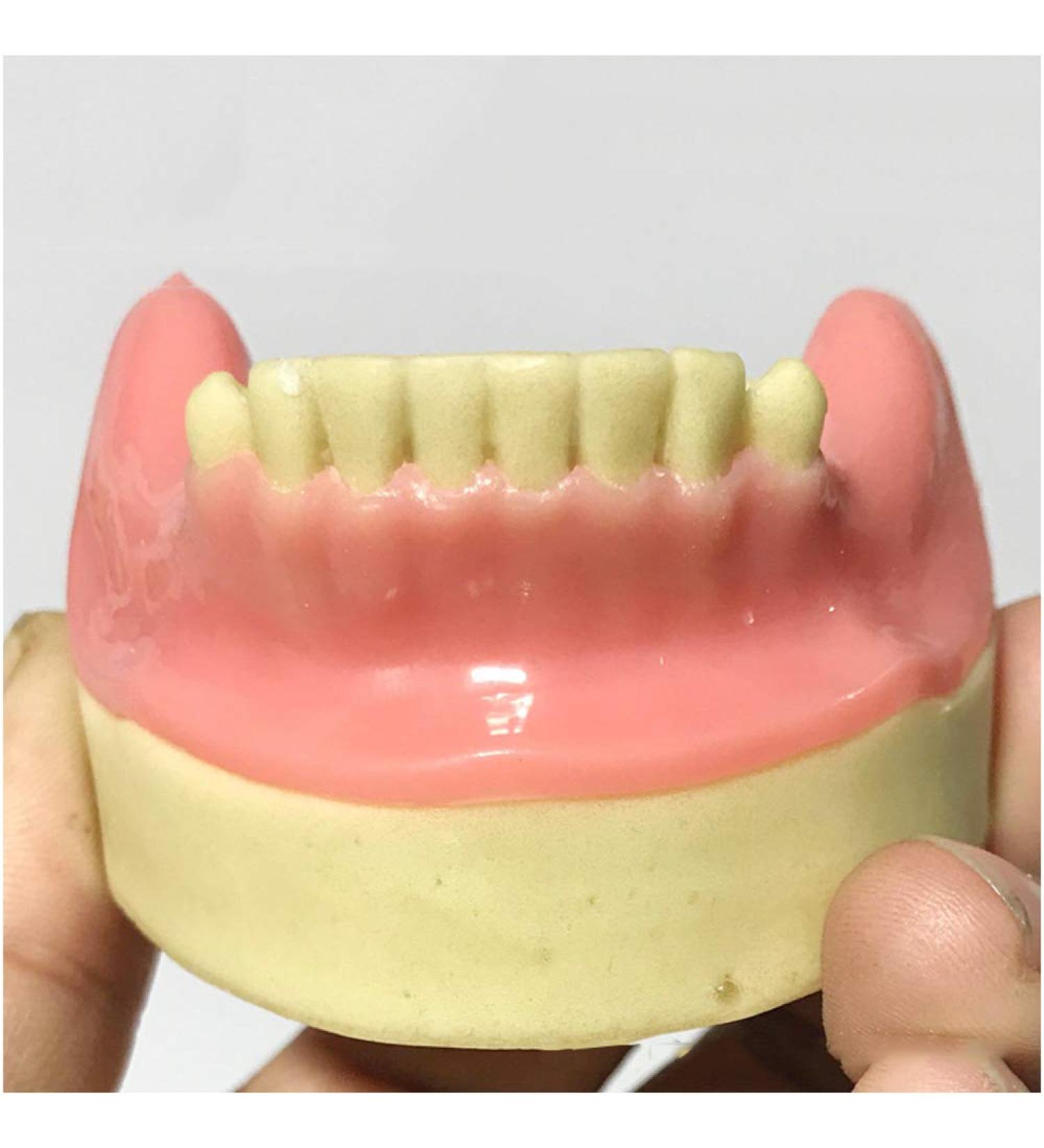 Buy Fhuili Dental Implant Practice Model - Mandibular Missing Teeth Simulation with Soft Gums for Oral Demonstration - Ideal for Dental Training - Buy Online on GoSupps.com